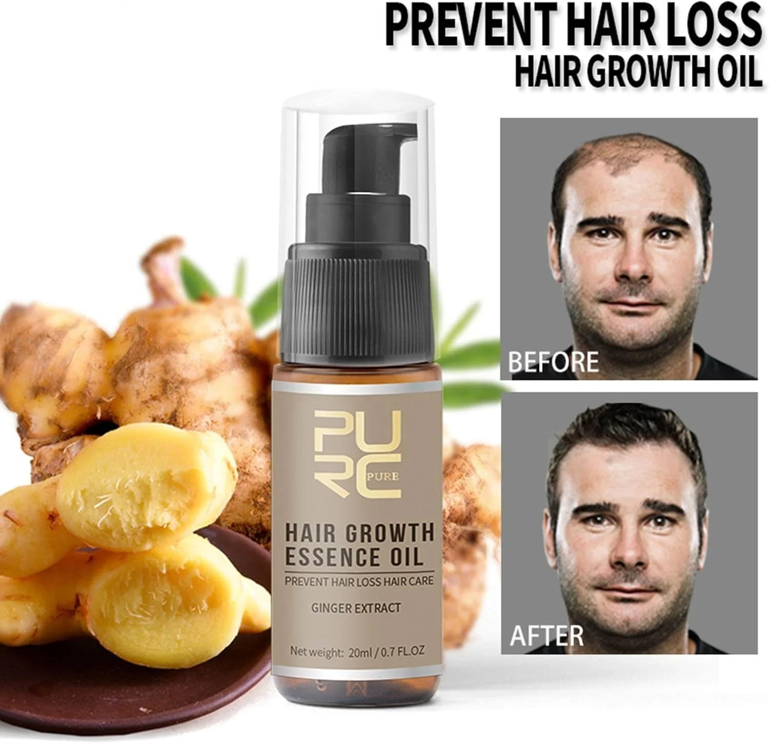 سرم های رشد مو 20 میلی لیتری، نرم کننده عمیق ترمیم کننده موهای آسیب دیده | درمان های جلوگیری از ریزش مو برای مردان و زنان با موهای نازک و کم پشت، 20 میلی لیتر