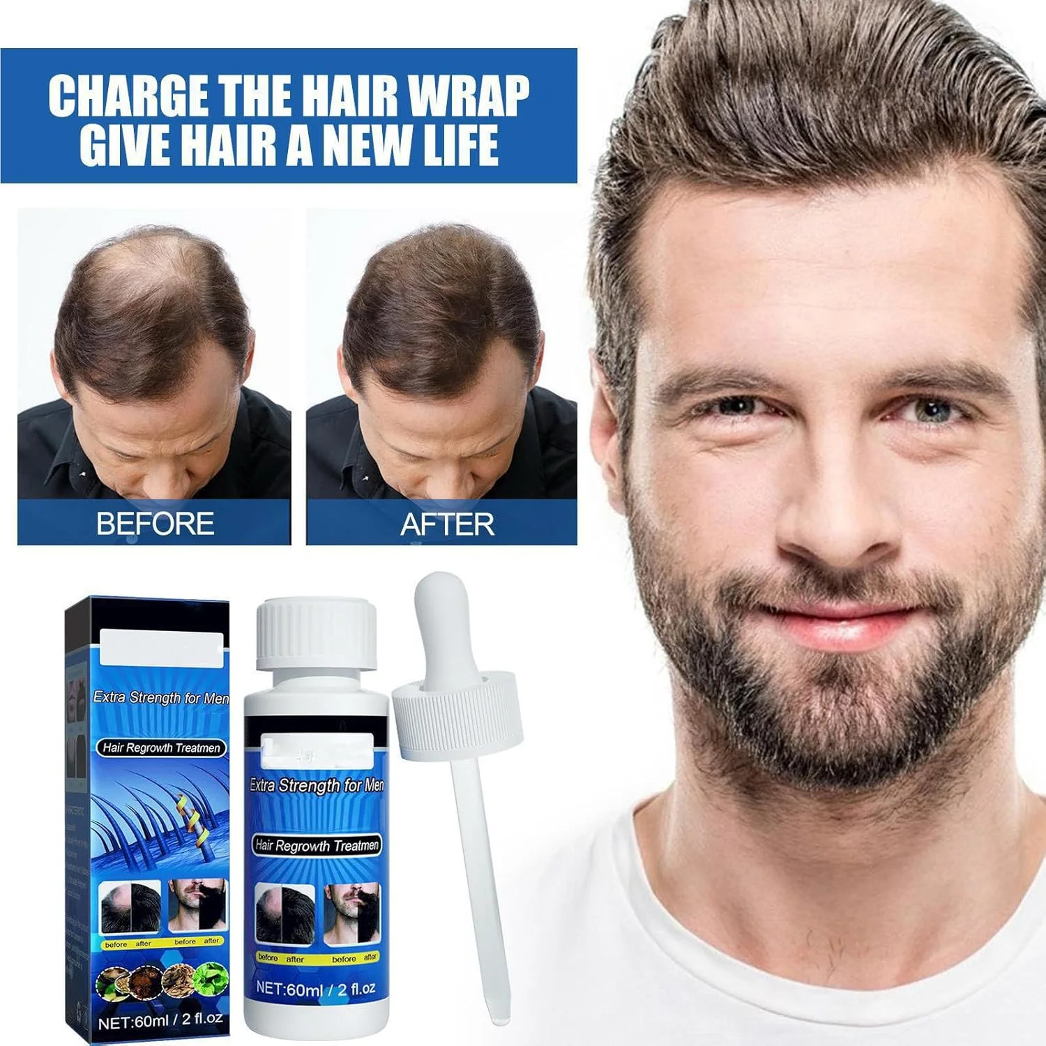 سرم رشد مو، حاوی بیوتین و روغن کرچک، محلول رشد مو، رشد مو، ضد ریزش مو، تقویت کننده موهای ضخیم تر و تغذیه کننده پوست سر برای آقایان و بانوان