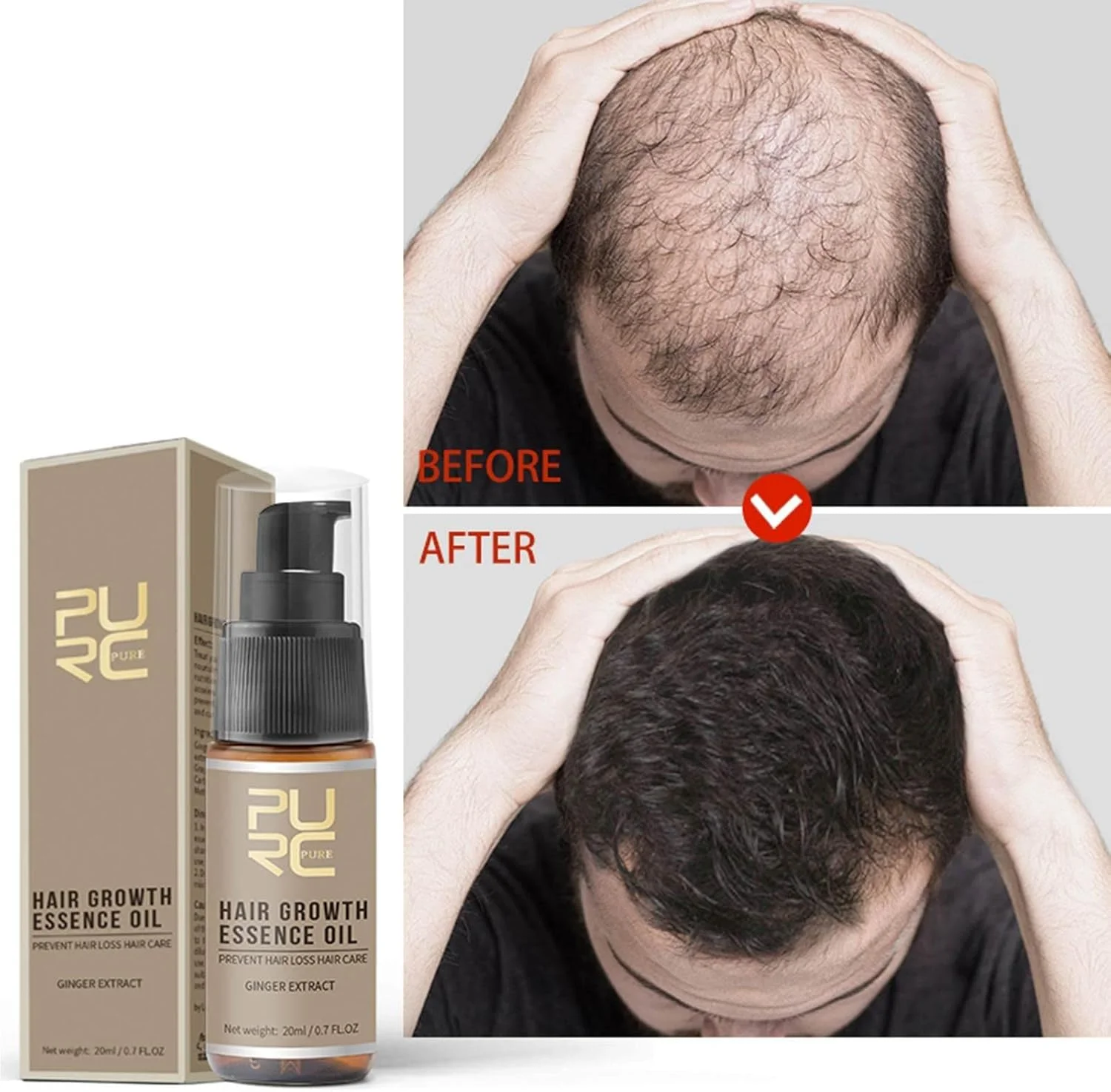 سرم های رشد مو 20 میلی لیتری، نرم کننده عمیق ترمیم کننده موهای آسیب دیده | درمان های جلوگیری از ریزش مو برای مردان و زنان با موهای نازک و کم پشت، 20 میلی لیتر