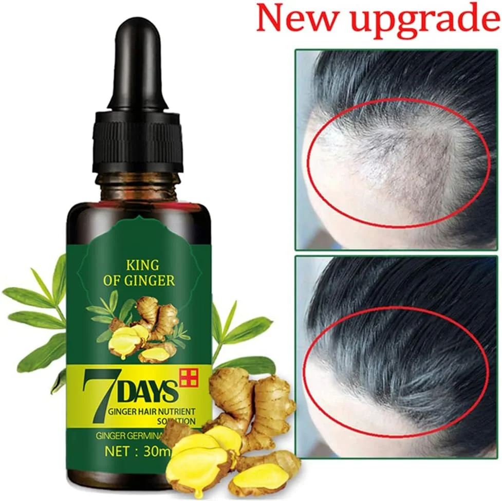 سرم رشد مو CLOTHES OF SKIN، محصول مراقبت از مو، سرم مو، رشد سریع مو، رشد و ضخیم شدن مو، توقف ریزش مو، رشد سریع مو، درمان ریزش مو برای مردان و زنان (30 میلی لیتر) سرم رشد مو CLOTHES OF SKIN، محصول مراقبت از مو، سرم مو، رشد سریع مو، رشد و ضخیم شدن مو، توقف ریزش مو، رشد سریع مو، درمان ریزش مو برای مردان و زنان (30 میلی لیتر)