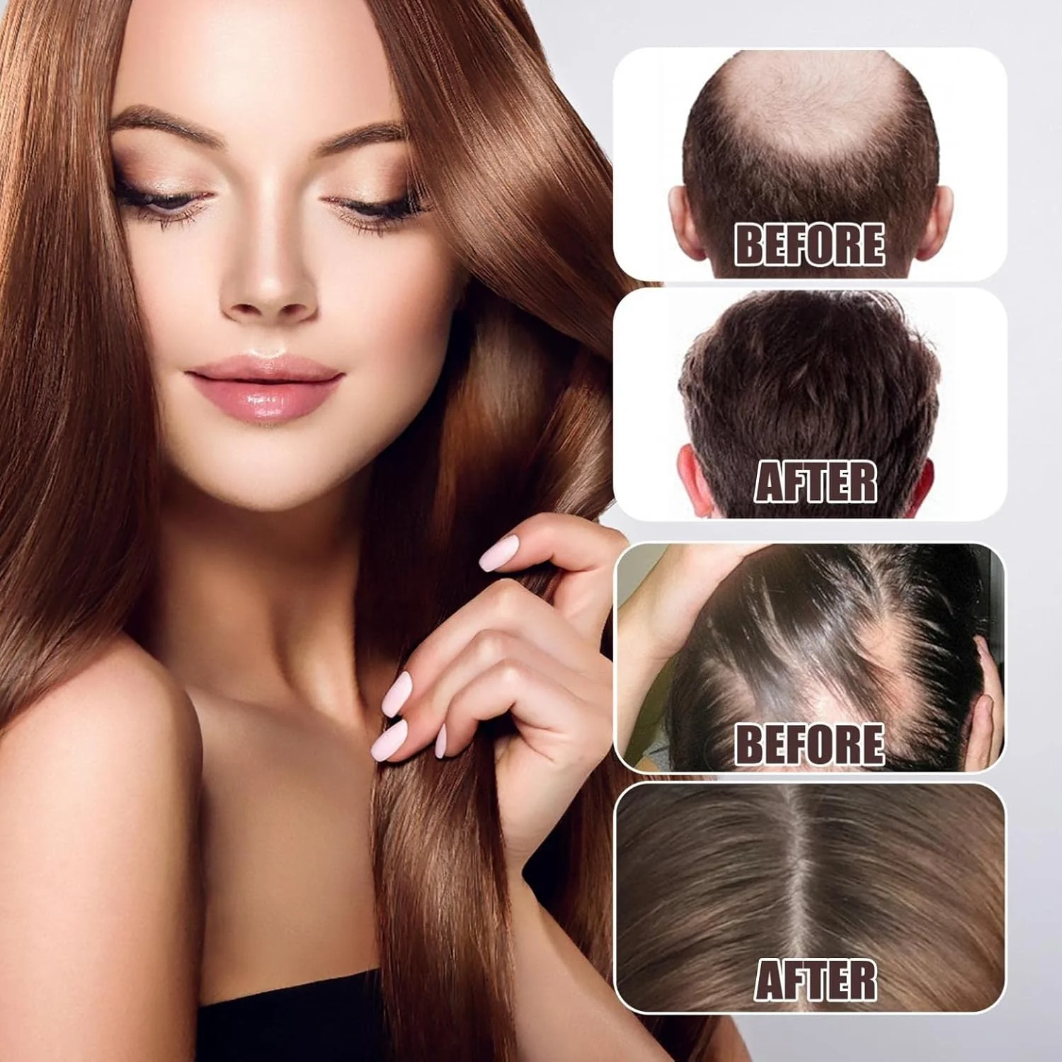 سرم آب برنج BULSM برای رشد مو، مناسب موهای نازک و جلوگیری از ریزش مو، روغن مراقبت از مو، رفع خشکی مو، سرم آب برنج تخمیر شده، 30 میلی لیتر سرم آب برنج BULSM برای رشد مو، مناسب موهای نازک و جلوگیری از ریزش مو، روغن مراقبت از مو، رفع خشکی مو، سرم آب برنج تخمیر شده، 30 میلی لیتر