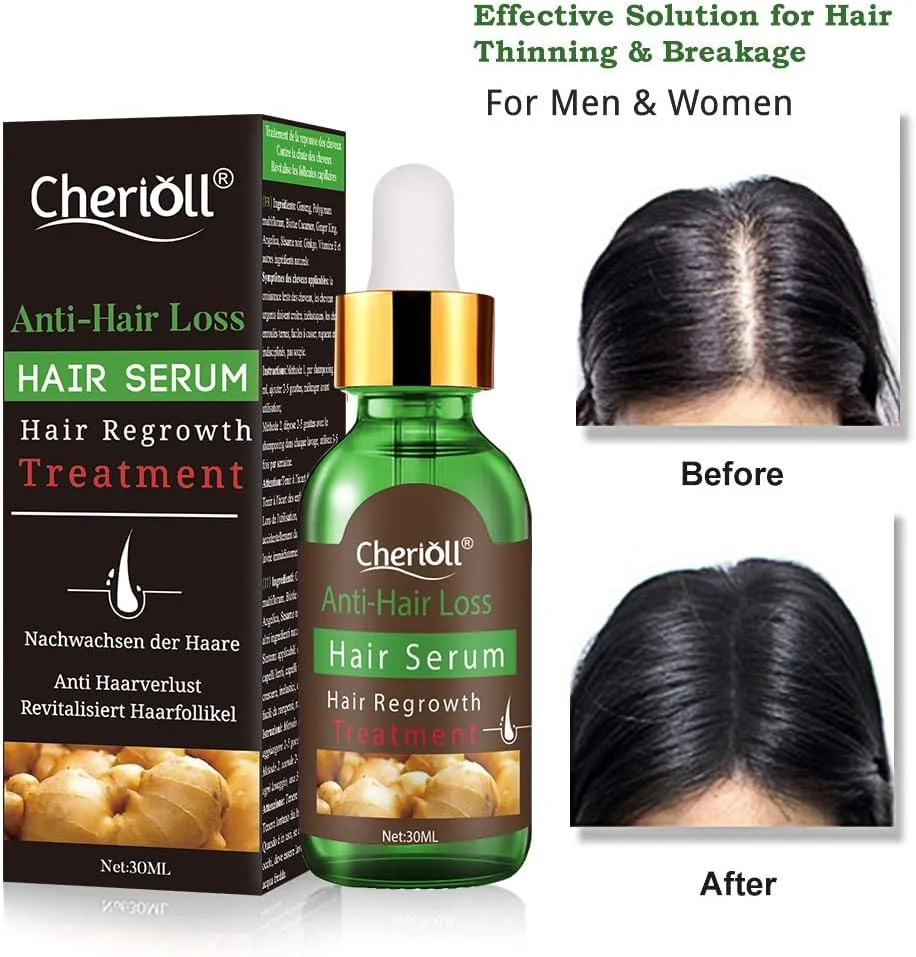 سرم رشد مو Cherioll، درمان ریزش مو و نازک شدن مو، توقف ریزش مو، نازک شدن، طاسی، ترمیم فولیکول های مو، تقویت موهای ضخیم تر، قوی تر و رشد موهای جدید سرم رشد مو Cherioll، درمان ریزش مو و نازک شدن مو، توقف ریزش مو، نازک شدن، طاسی، ترمیم فولیکول های مو، تقویت موهای ضخیم تر، قوی تر و رشد موهای جدید