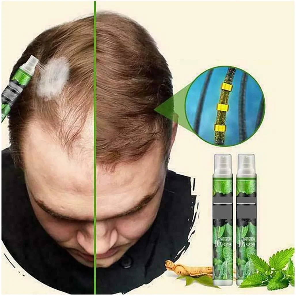 اسپری سرم رشد موی طبیعی BOLHGF، ضد ریزش مو، رشد سریع، جلوگیری از خشکی مو، اسپری سرم رشد مو، اسپری رشد مو برای تقویت، ضخیم شدن و مراقبت روزانه از مو (2 عدد)