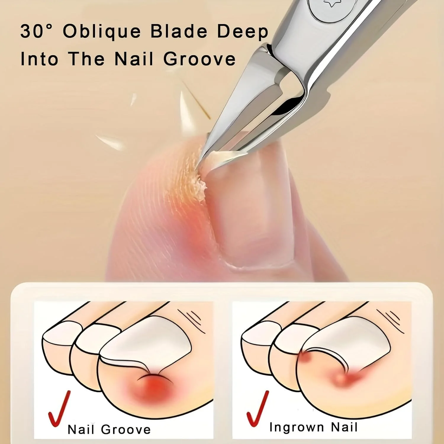 ناخن گیر ارگونومیک با دسته آسان گیر برای ناخن های فرورفته، نوک تیز دقیق، ابزار حرفه ای پا پزشکی - سفید، سایز متوسط