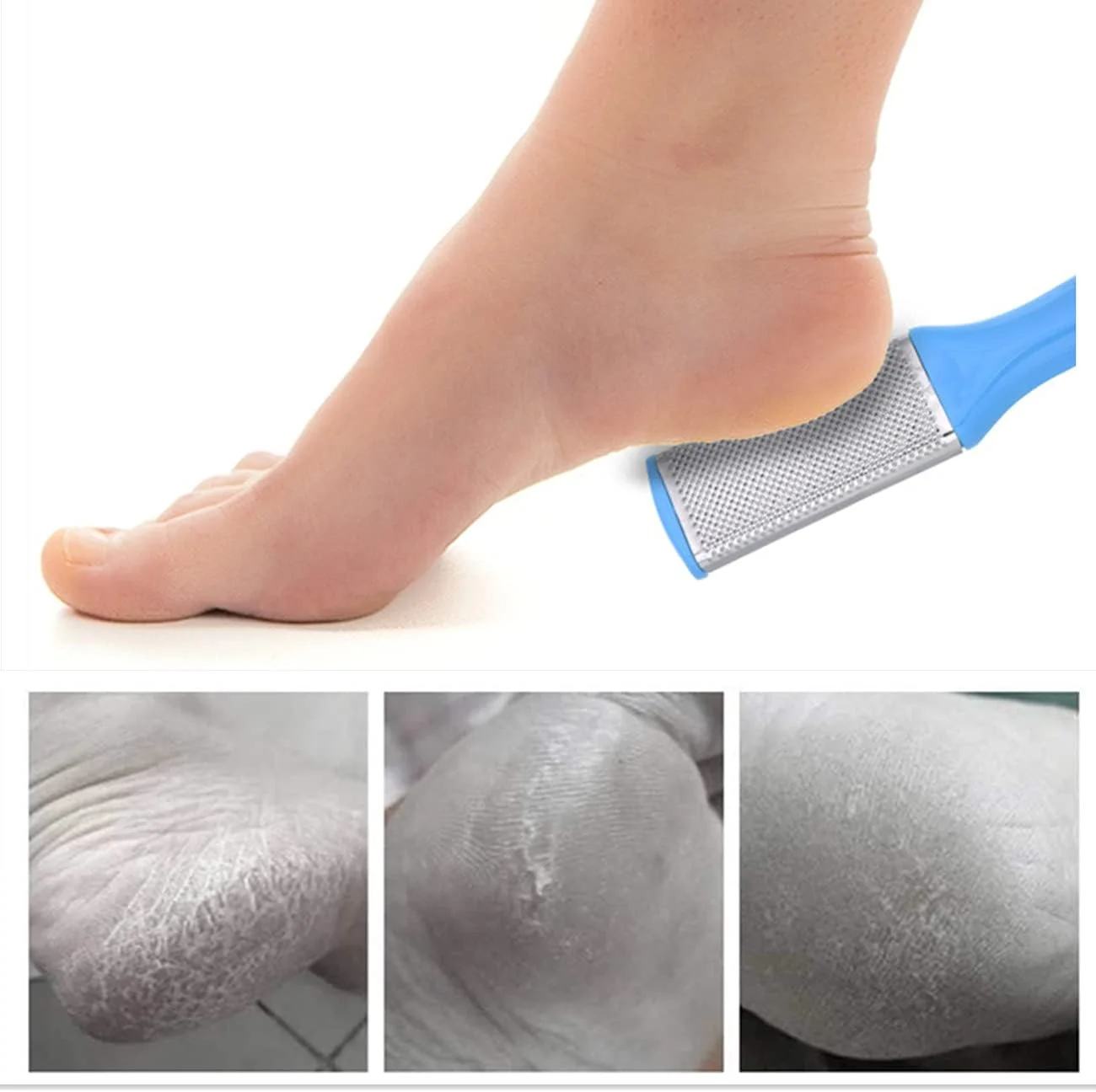 ست پدیکور U-HOOME، مجموعه 20 عددی ابزار پدیکور حرفه ای، ست مراقبت از پا از جنس استیل ضد زنگ برای از بین بردن پوست سفت و پوست سر