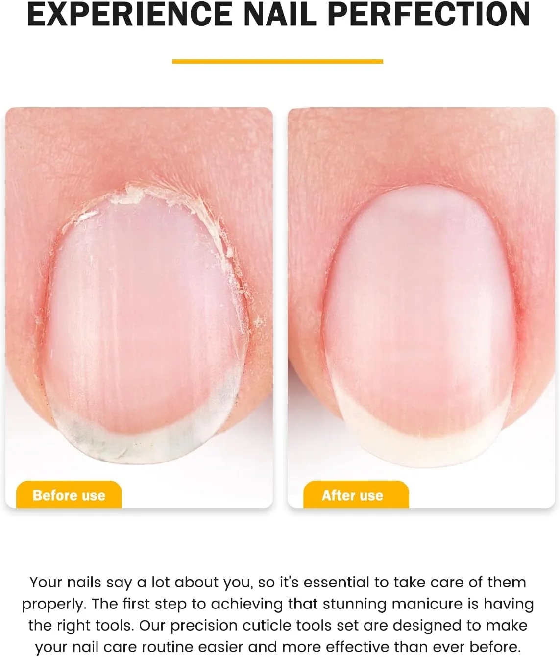 ست نیپر کوتیکول BEZOX با عقب زننده کوتیکول - نیپر دقیق کوتیکول و کیت تمیز کننده زیر ناخن برای استفاده در سالن یا منزل - فک کامل 0.8 سانتی متری - فولاد ضد زنگ درجه جراحی ست نیپر کوتیکول BEZOX با عقب زننده کوتیکول - نیپر دقیق کوتیکول و کیت تمیز کننده زیر ناخن برای استفاده در سالن یا منزل - فک کامل 0.8 سانتی متری - فولاد ضد زنگ درجه جراحی