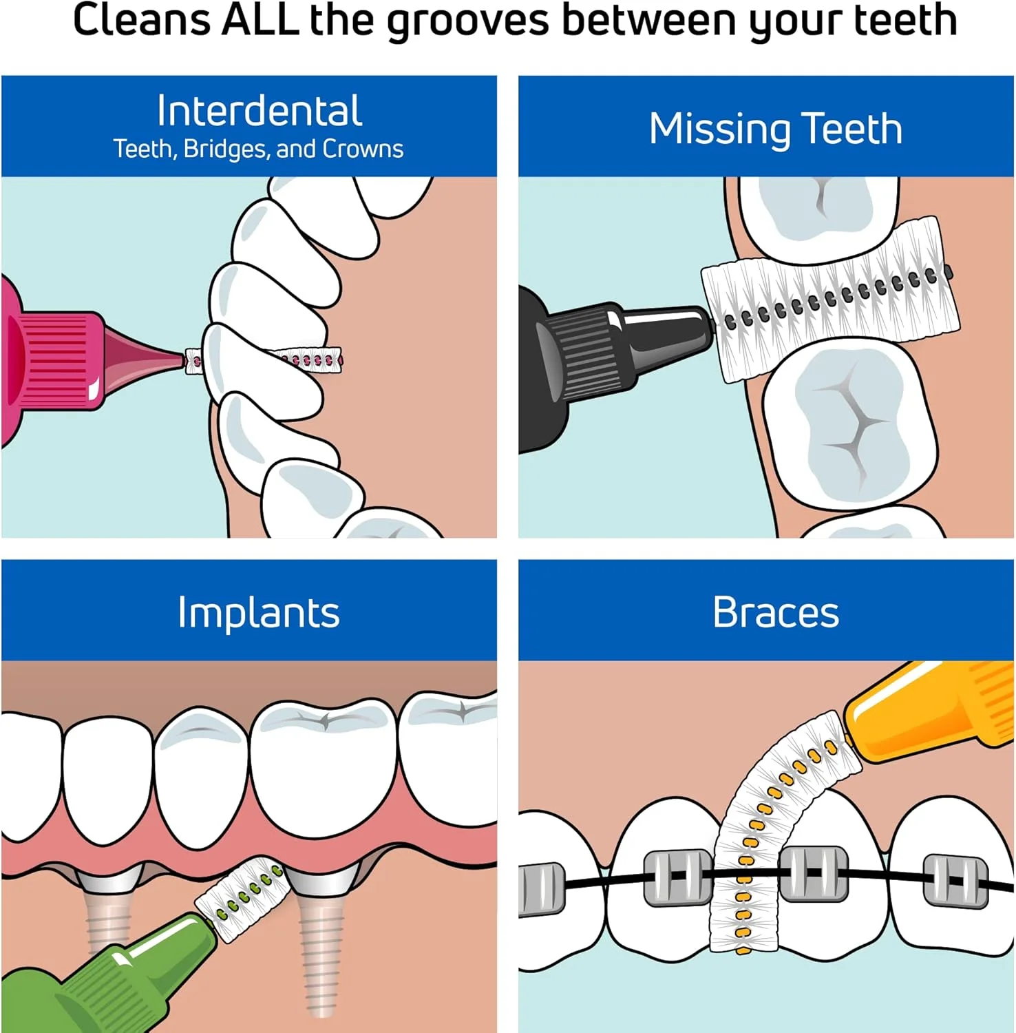برس های بین دندانی اورجینال TePe، 0.4 میلی متر، صورتی (بسته 25 عددی)، بسته چندتایی 25 عددی برس های بین دندانی اورجینال TePe، 0.4 میلی متر، صورتی (بسته 25 عددی)، بسته چندتایی 25 عددی