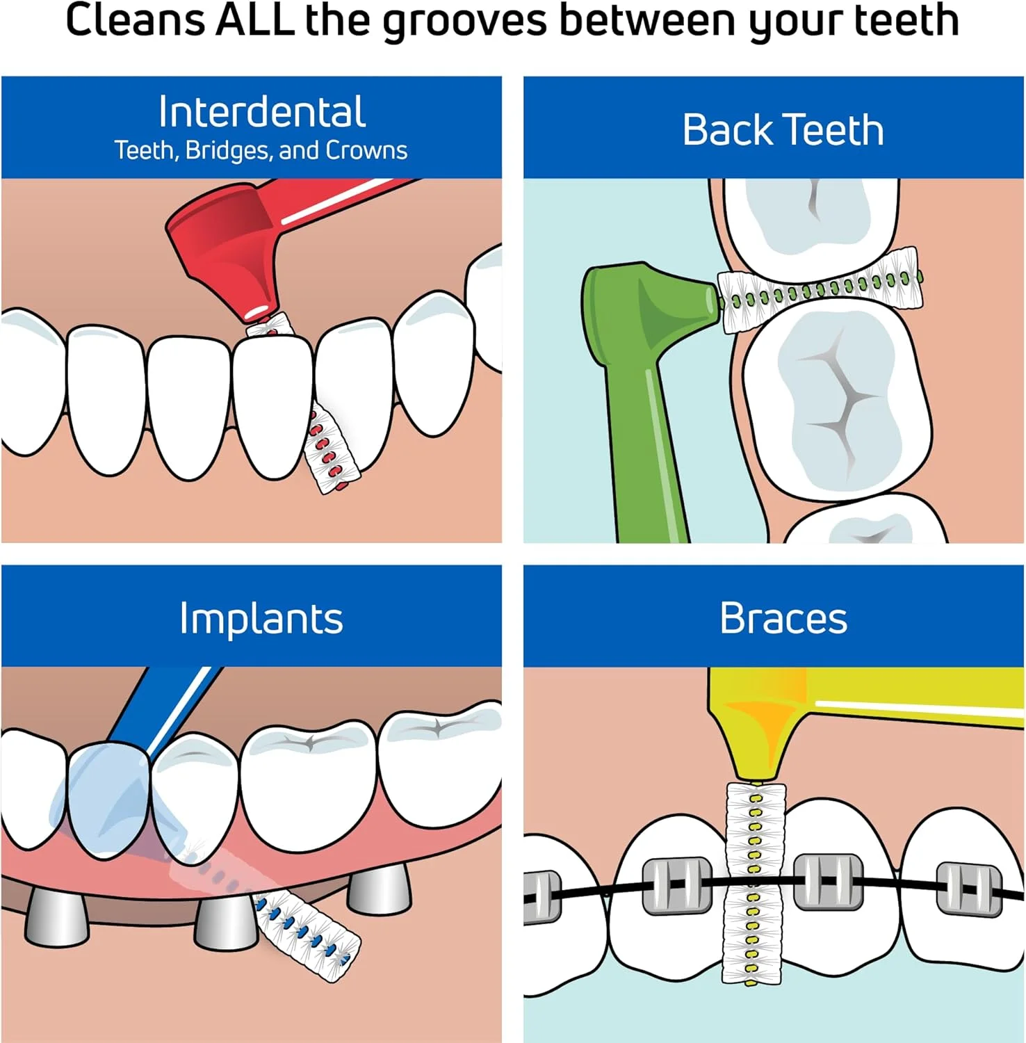 برس های بین دندانی زاویه دار آبی TePe (0.6 میلی متر - سایز 3) 1 بسته 6 عددی