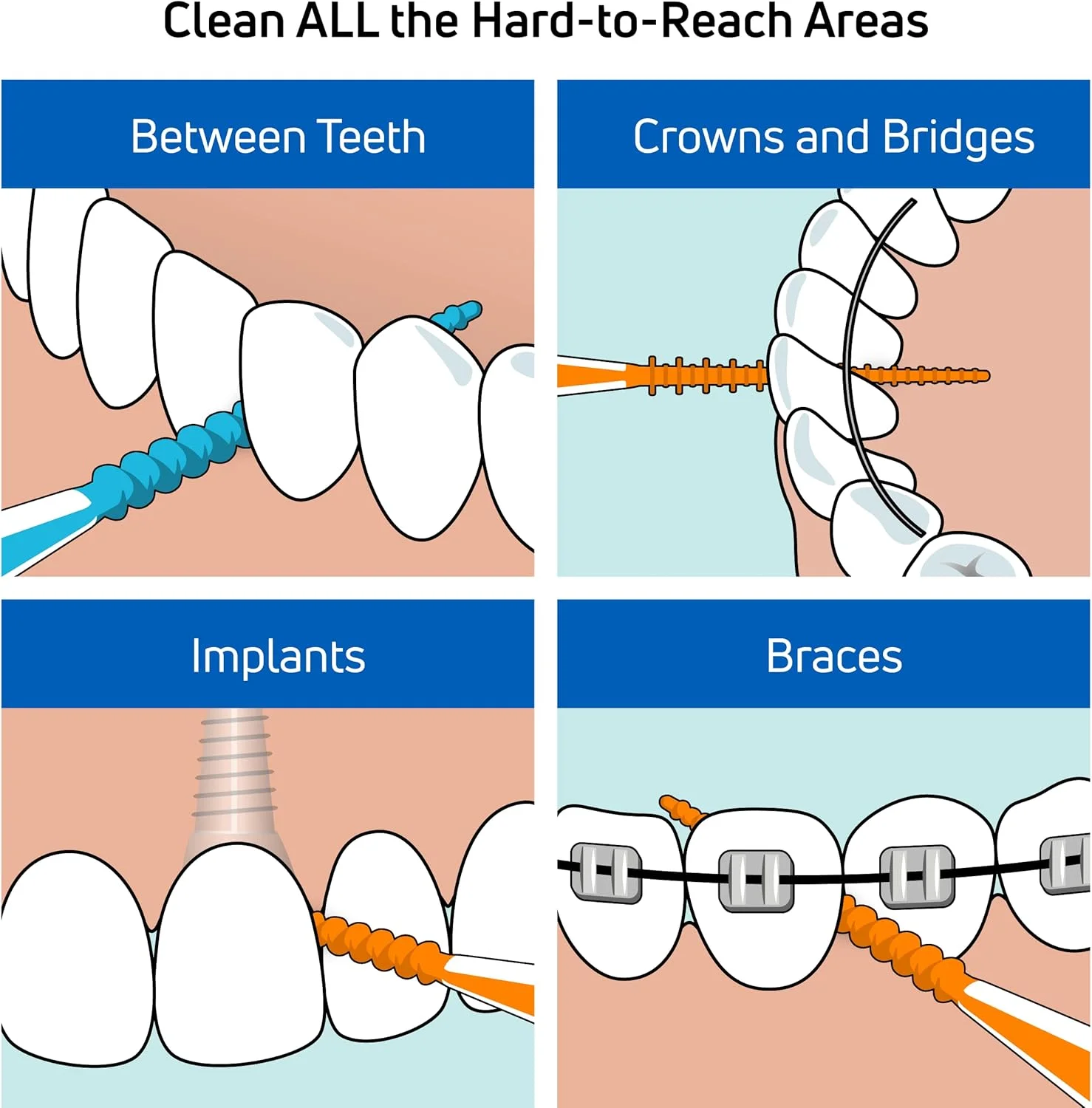 نخ دندان دسته دار TePe، خلال دندان، نخ دندان، EasyPicks XS/S، نارنجی، بسته 60 عددی نخ دندان دسته دار TePe، خلال دندان، نخ دندان، EasyPicks XS/S، نارنجی، بسته 60 عددی