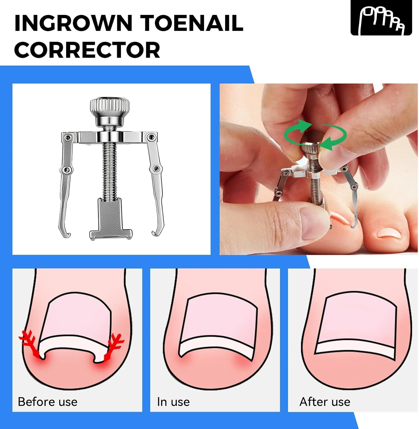 ست ۹ عددی سوهان ناخن و ناخن پا فرورفته، ابزار مانیکور و پدیکور ناخن از جنس استیل ضد زنگ برای دست و پا ست ۹ عددی سوهان ناخن و ناخن پا فرورفته، ابزار مانیکور و پدیکور ناخن از جنس استیل ضد زنگ برای دست و پا