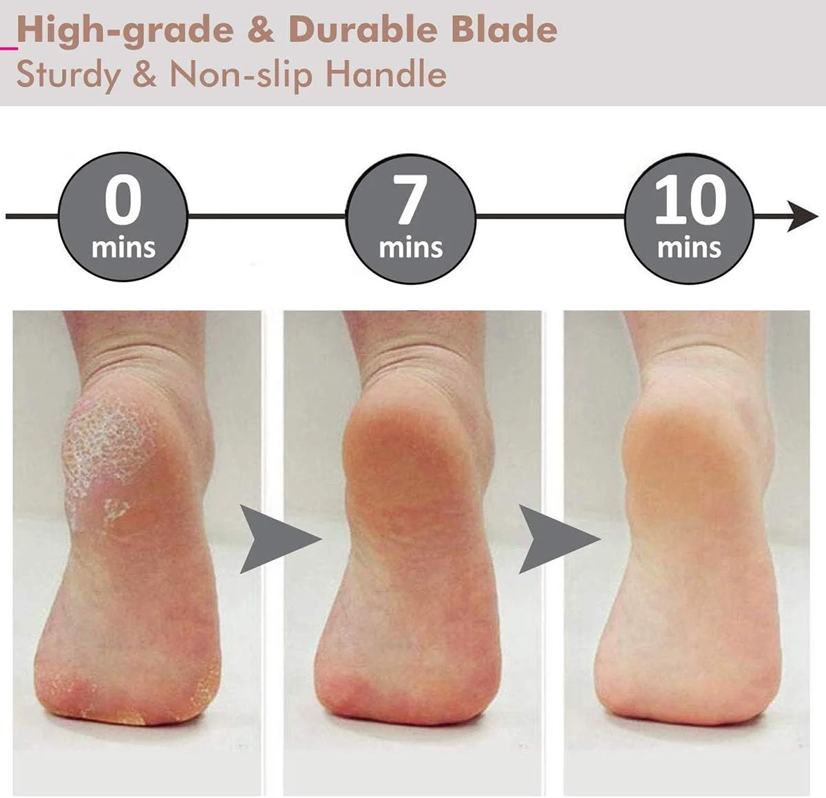 سوهان پدیکور پا DELFINO، رنده پای بزرگ، از بین برنده پینه پا، اسکرابر بزرگ استیل ضد زنگ پا، ابزار پدیکور مراقبت از پا، از بین برنده پوست سخت برای پاهای خشک و مرطوب سوهان پدیکور پا DELFINO، رنده پای بزرگ، از بین برنده پینه پا، اسکرابر بزرگ استیل ضد زنگ پا، ابزار پدیکور مراقبت از پا، از بین برنده پوست سخت برای پاهای خشک و مرطوب