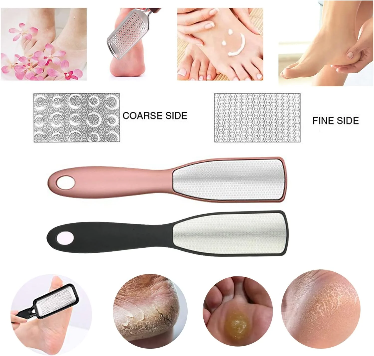 جیستل (صورتی) - سوهان پا دو طرفه حرفه ای استیل ضد زنگ، از بین برنده ترک پا، پوست مرده، ضخیم، خشک و سفت (صورتی) جیستل (صورتی) - سوهان پا دو طرفه حرفه ای استیل ضد زنگ، از بین برنده ترک پا، پوست مرده، ضخیم، خشک و سفت (صورتی)