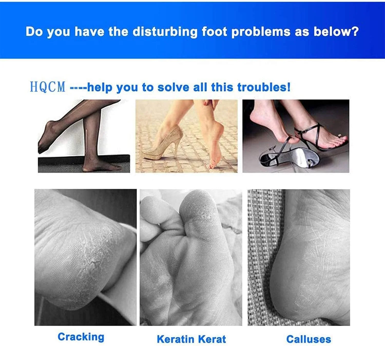 ست مراقبت از پا 8 در 1 حرفه ای KASTWAVE - ابزار پدیکور استیل ضد زنگ، شامل سوهان پا، ناخن گیر و از بین برنده پوست مرده برای داشتن پاهایی صاف ست مراقبت از پا 8 در 1 حرفه ای KASTWAVE - ابزار پدیکور استیل ضد زنگ، شامل سوهان پا، ناخن گیر و از بین برنده پوست مرده برای داشتن پاهایی صاف