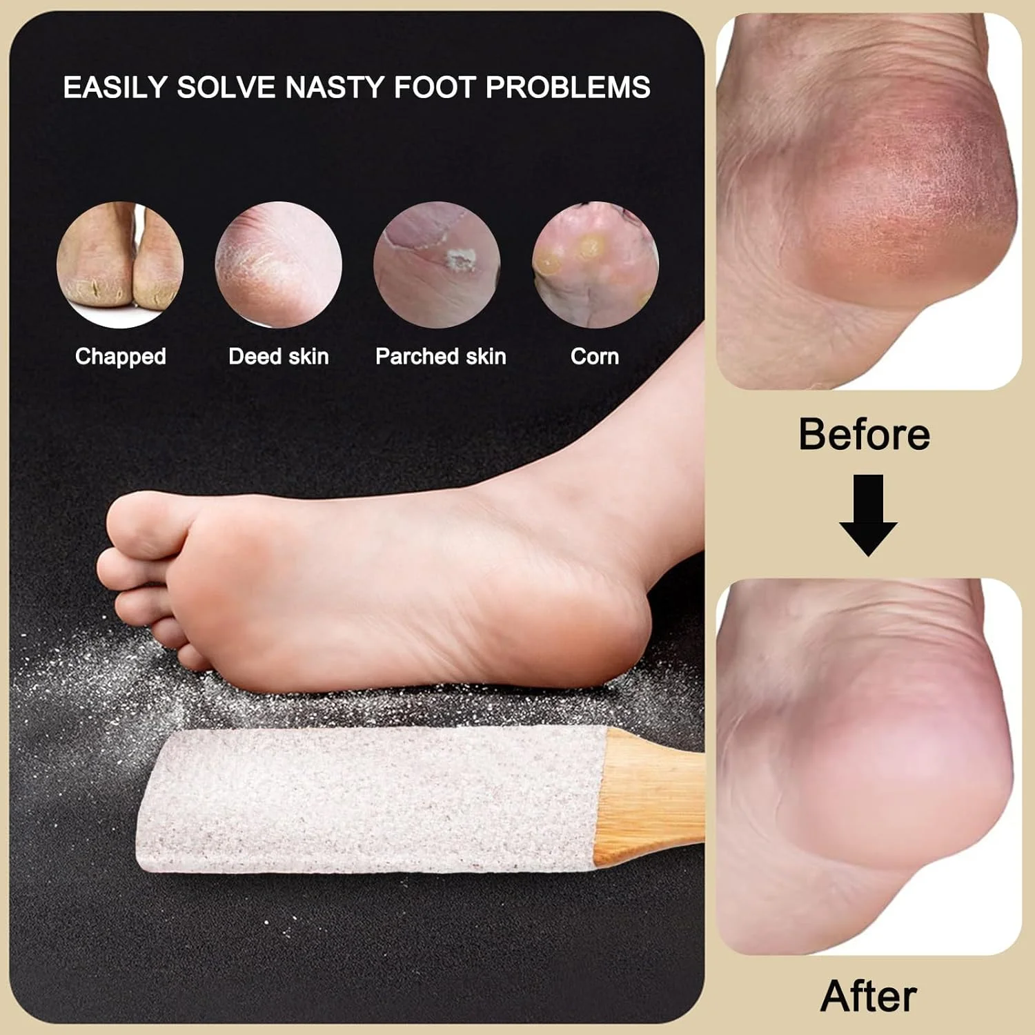 سوهان پا حرفه ای ژوفرمین، از بین برنده موثر پینه و اسکرابر پا برای پاشنه های ترک خورده، پوست مرده، میخچه و پوست سخت، سنگ پا برای پاهای خیس و خشک (سنگ کوراندوم سفید)