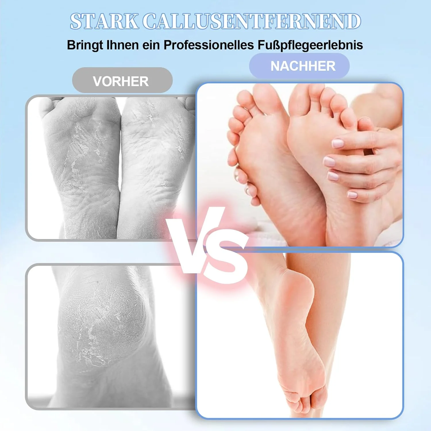 سوهان برقی پا 2 در 1 FIVAVA، سمباده حرفه ای پدیکور پا، 9 سرعت قابل تنظیم، سوهان قدرتمند پدیکور پا برای پاشنه های ترک خورده، پینه ها، پوست مرده (مشکی)