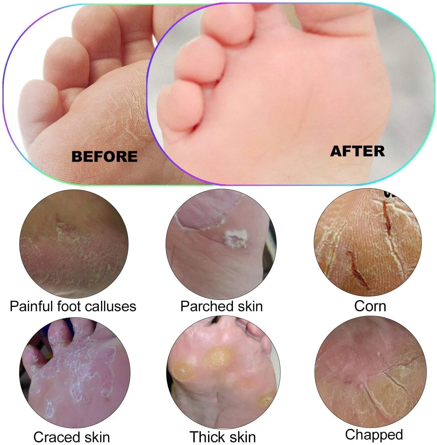 سوهان پا و از بین برنده پینه Excefore Professional - رنده پدیکور برای پاهای خشک و مرطوب - اسکرابر طلایی بزرگ برای نرم کردن پوست سوهان پا و از بین برنده پینه Excefore Professional - رنده پدیکور برای پاهای خشک و مرطوب - اسکرابر طلایی بزرگ برای نرم کردن پوست