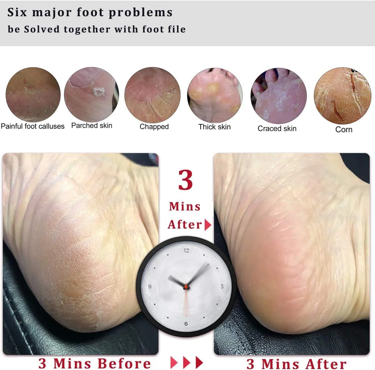 سوهان پا از بین برنده پینه و اسکرابر پا، رنده پدیکور حرفه ای پا از بین برنده ترک پاشنه پا، پوست مرده، میخچه، پوست سخت، سنگ پا برای ابزار برس سوهان خراشنده برای پاهای مرطوب و خشک سوهان پا از بین برنده پینه و اسکرابر پا، رنده پدیکور حرفه ای پا از بین برنده ترک پاشنه پا، پوست مرده، میخچه، پوست سخت، سنگ پا برای ابزار برس سوهان خراشنده برای پاهای مرطوب و خشک