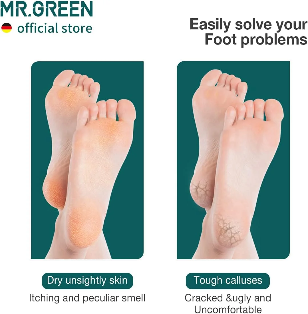 سوهان پا دو طرفه MR.GREEN، ابزار حرفه ای پدیکور، از بین برنده پینه پا، سوهان استیل ضد زنگ برای پا (سبز) سوهان پا دو طرفه MR.GREEN، ابزار حرفه ای پدیکور، از بین برنده پینه پا، سوهان استیل ضد زنگ برای پا (سبز)