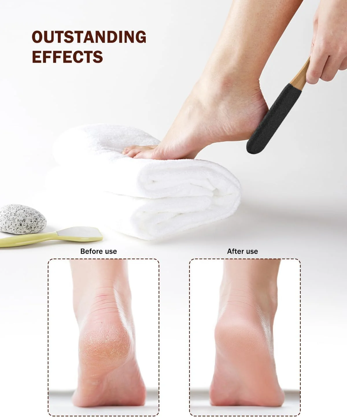 سوهان پا KASTWAVE، از بین برنده پینه پا، سنگ پا، سوهان پدیکور حرفه ای پا، از بین برنده ترک پاشنه پا، پوست مرده، میخچه، پوست سخت، برای پاهای خشک و مرطوب سوهان پا KASTWAVE، از بین برنده پینه پا، سنگ پا، سوهان پدیکور حرفه ای پا، از بین برنده ترک پاشنه پا، پوست مرده، میخچه، پوست سخت، برای پاهای خشک و مرطوب