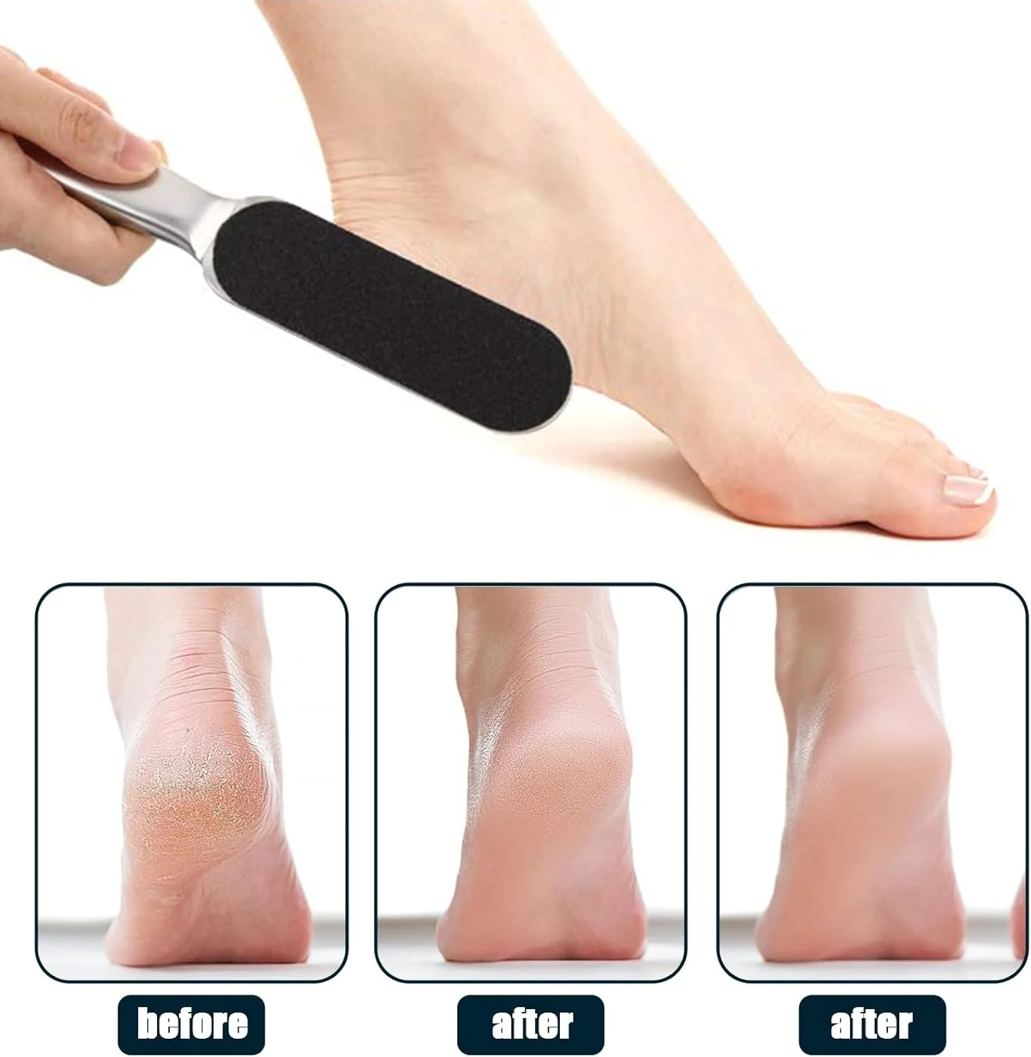 سوهان پا برای از بین بردن پینه و 20 عدد سمباده (زبر/نرم)، از بین برنده پینه برای پاهای ترک خورده خشک و مرطوب، سوهان پا و سوهان پینه (دانه بندی 100 و 180) سوهان پا برای از بین بردن پینه و 20 عدد سمباده (زبر/نرم)، از بین برنده پینه برای پاهای ترک خورده خشک و مرطوب، سوهان پا و سوهان پینه (دانه بندی 100 و 180)