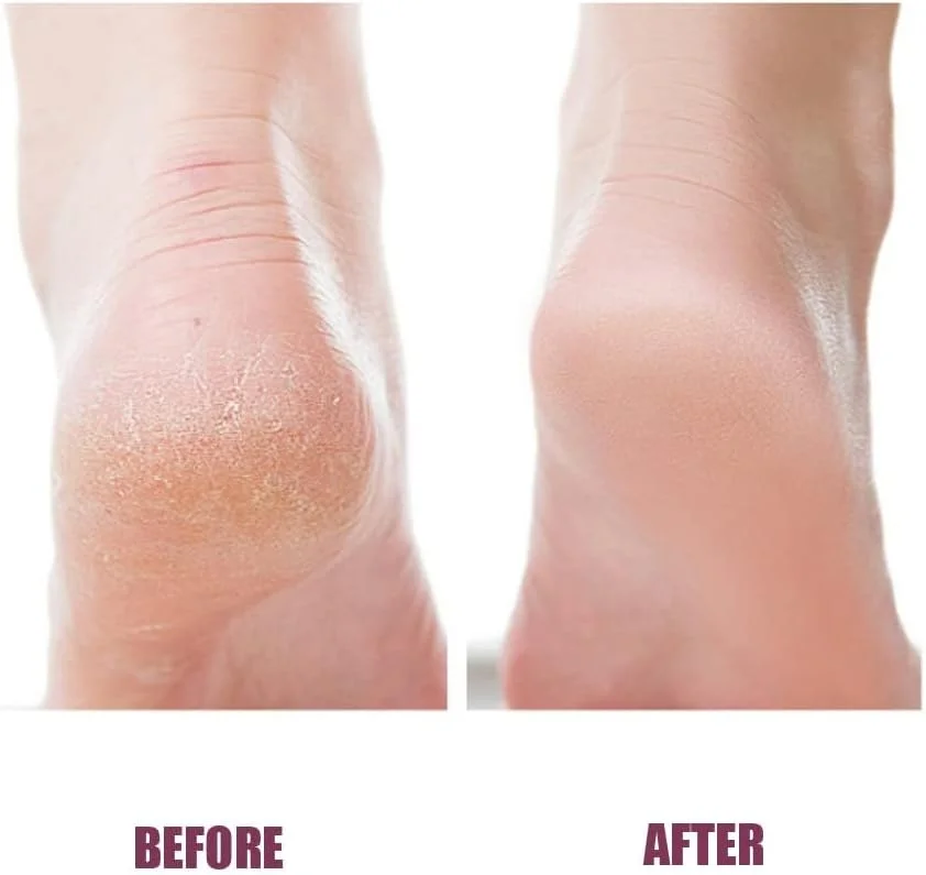 سوهان نانو پا - سوهان ناخن نانو شیشه ای از بین برنده پینه دست و پا، از بین برنده پینه پا، اسکرابر پدیکور حرفه ای، ابزار پدیکور مراقبت از پا، اسکرابر برای پوست مرده پا سوهان نانو پا - سوهان ناخن نانو شیشه ای از بین برنده پینه دست و پا، از بین برنده پینه پا، اسکرابر پدیکور حرفه ای، ابزار پدیکور مراقبت از پا، اسکرابر برای پوست مرده پا