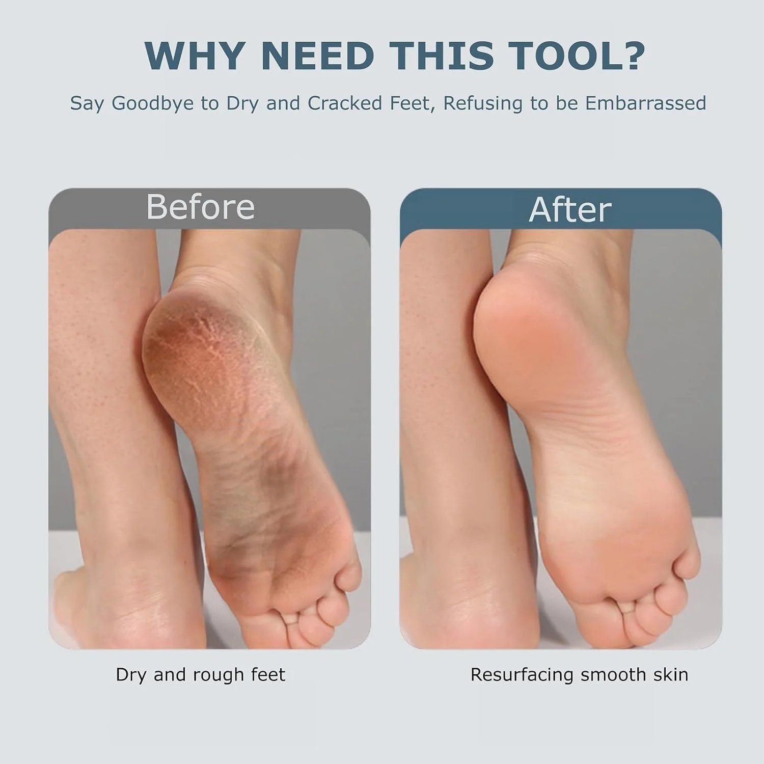 سوهان برقی پا، کیت پدیکور الکترونیکی قابل حمل و شارژی، سوهان برقی ضد آب پا، ابزار حرفه ای پدیکور و مراقبت از پا، مراقبت از پا برای پوست های مرده