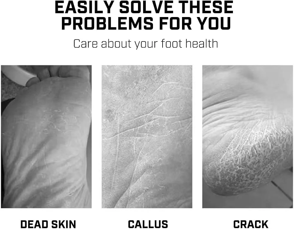 سوهان پا، فایل پا و از بین برنده پینه، ابزار پدیکور مراقبت از پا با سطح فلزی برای از بین بردن پوست سخت سوهان پا، فایل پا و از بین برنده پینه، ابزار پدیکور مراقبت از پا با سطح فلزی برای از بین بردن پوست سخت