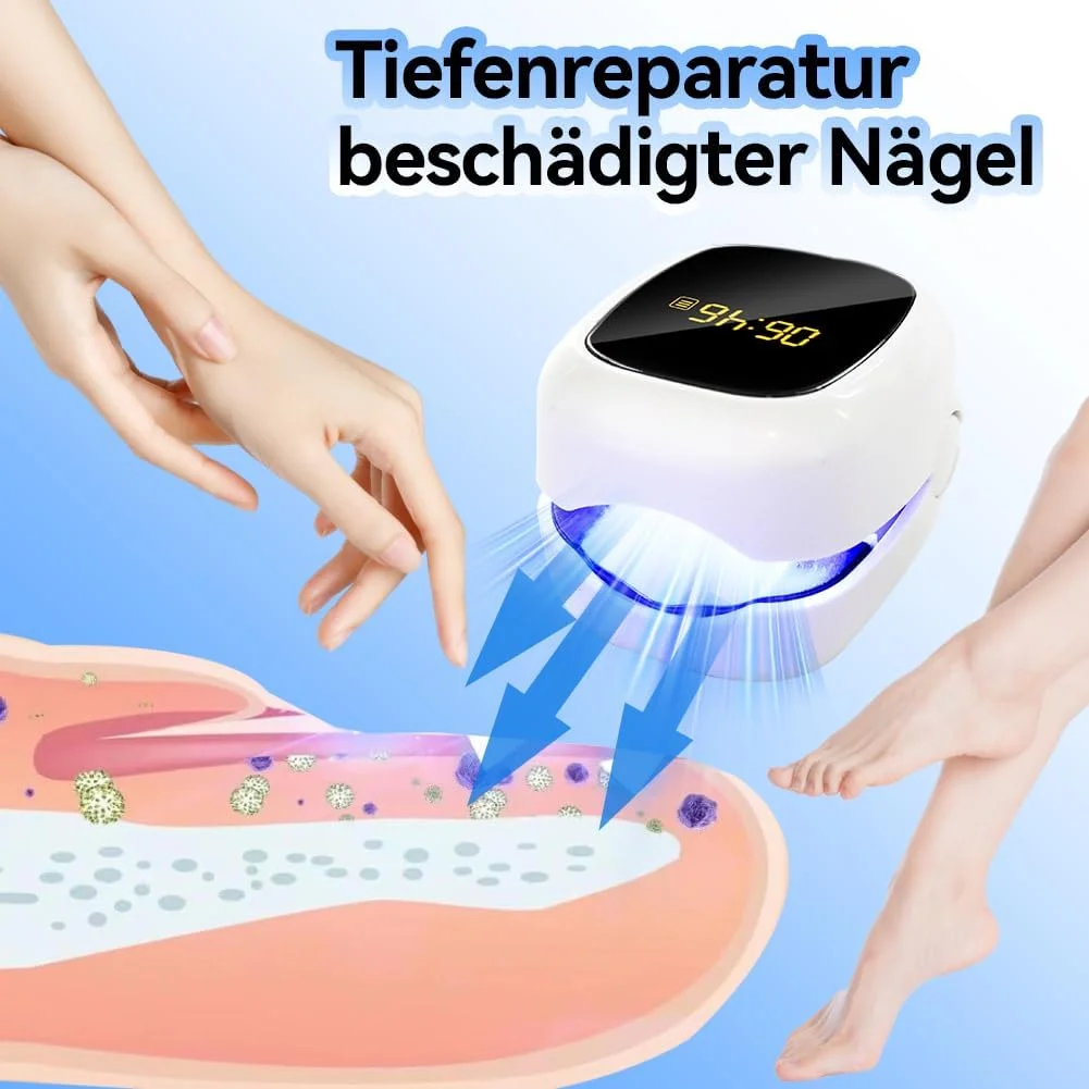 دستگاه لیزر قارچ ناخن Aohcae، دستگاه لیزر قارچ ناخن، عملکرد سریع، نور درمانی چند منظوره برای ناخن های دست و پا با نور آبی 500 نانومتر، قرمز 660 نانومتر و مادون قرمز 950 نانومتر