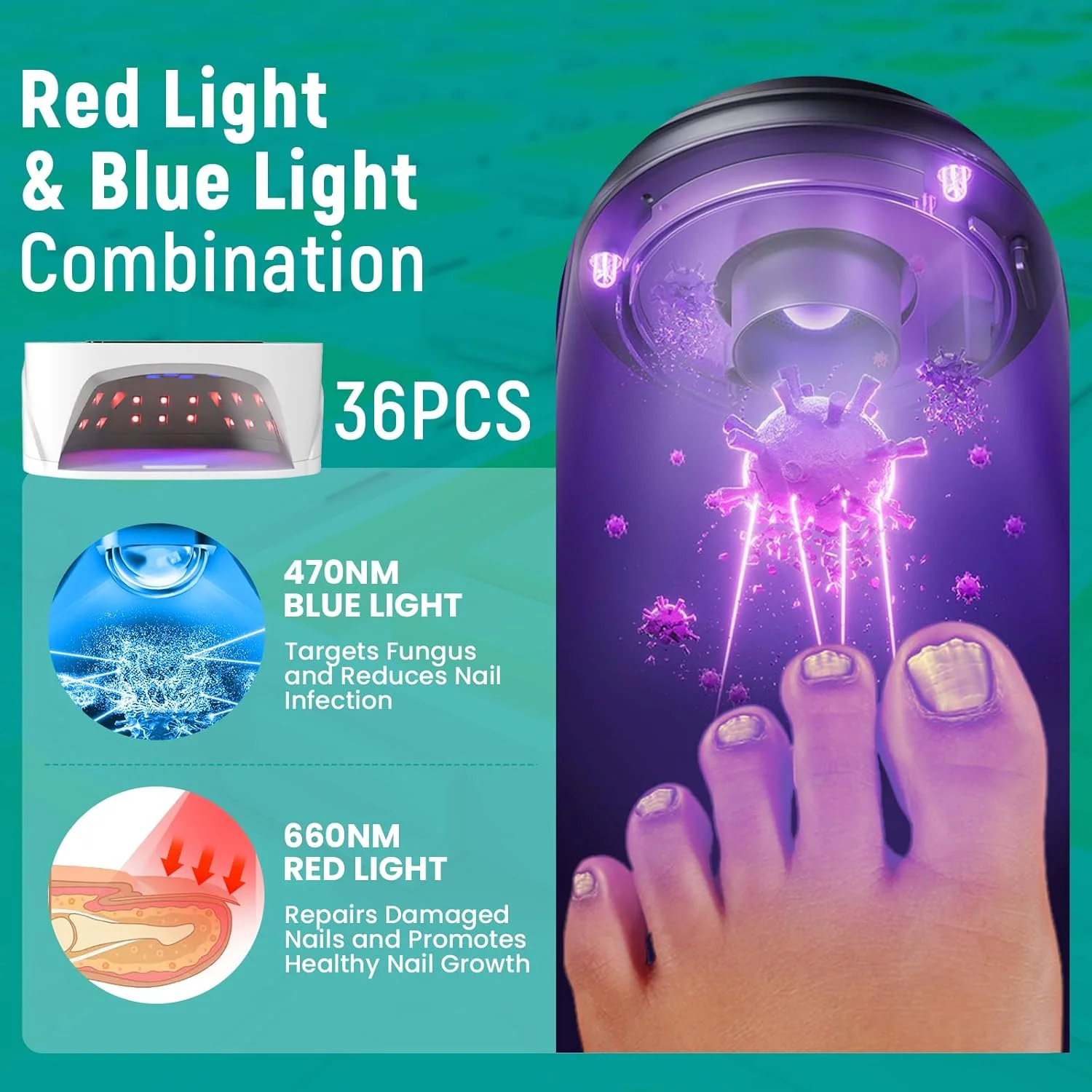 دستگاه لیزر قارچ ناخن iKeener، دستگاه درمان قارچ ناخن بی سیم آبی و قرمز دارای تاییدیه FDA با 36 لامپ، برای چندین ناخن پا و ناخن دست