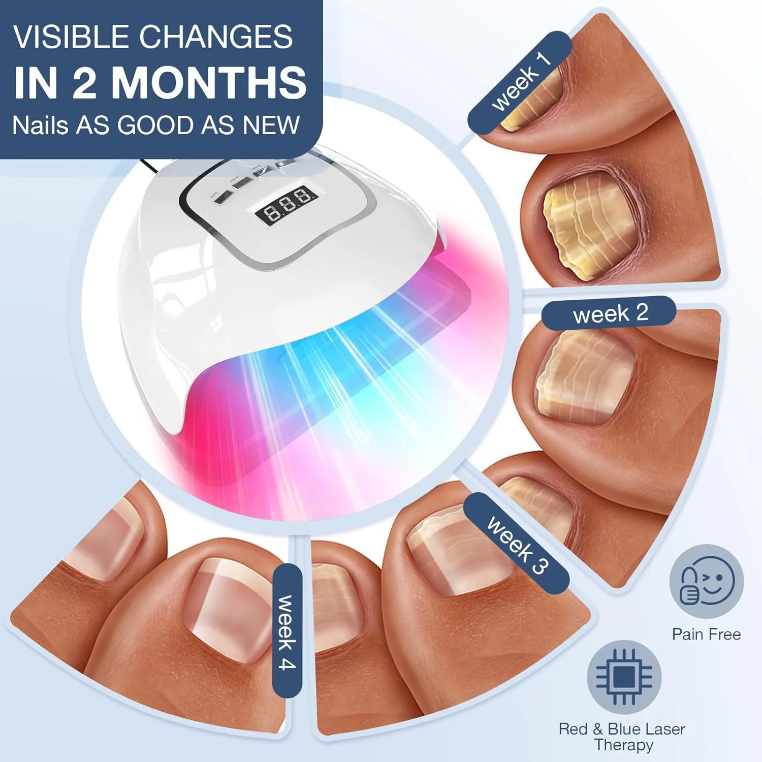 دستگاه لیزر قارچ ناخن iKeener، دستگاه تمیز کننده ناخن با لیزر برای انگشتان دست و اونیکومیکوز، از بین برنده قارچ ناخن، دارای 15 نور آبی 470 نانومتری + 30 نور قرمز 650 نانومتری، جلسات قابل تنظیم 3/5/7 دقیقه ای دستگاه لیزر قارچ ناخن iKeener، دستگاه تمیز کننده ناخن با لیزر برای انگشتان دست و اونیکومیکوز، از بین برنده قارچ ناخن، دارای 15 نور آبی 470 نانومتری + 30 نور قرمز 650 نانومتری، جلسات قابل تنظیم 3/5/7 دقیقه ای
