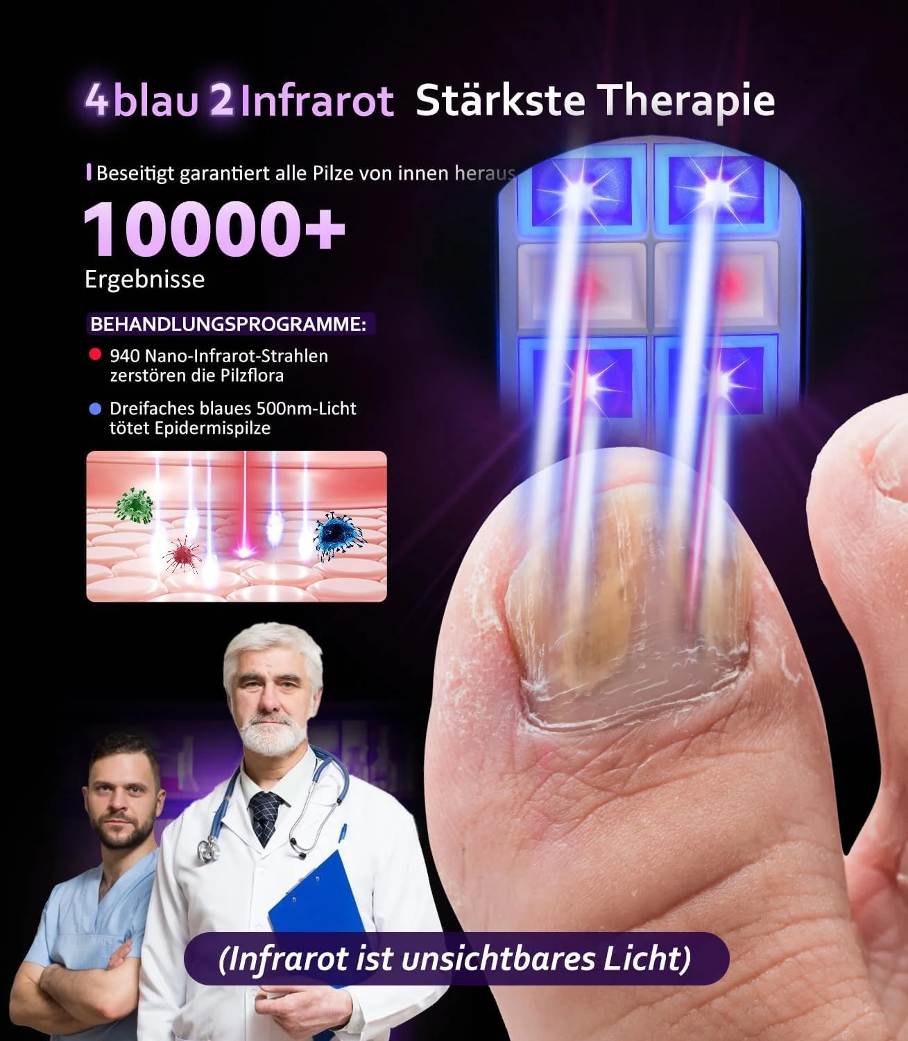 دستگاه لیزر قارچ ناخن LOZLTX 5.0، ارتقا یافته با 4 نور آبی 470 نانومتری و 2 نور مادون قرمز 905 نانومتری، اثرگذاری قابل مشاهده در 21 روز، اثربخشی دو برابر، استفاده آسان برای ناخن های تغییر رنگ یافته، کنترل موثر قارچ