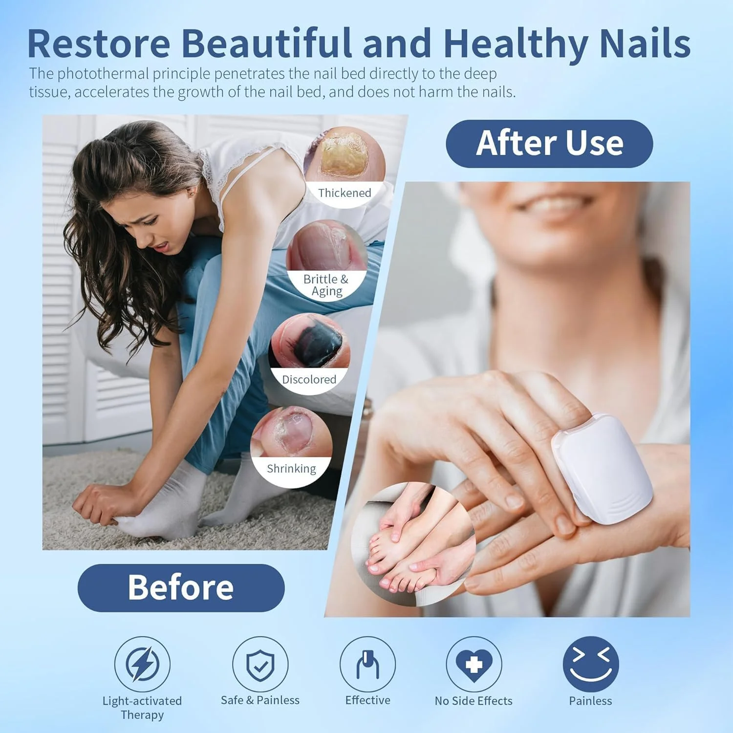 دستگاه درمان ناخن ویفوم - سفید - درمان تغییر شکل ناخن - دستگاه - مراقبت از ناخن - 12149521031