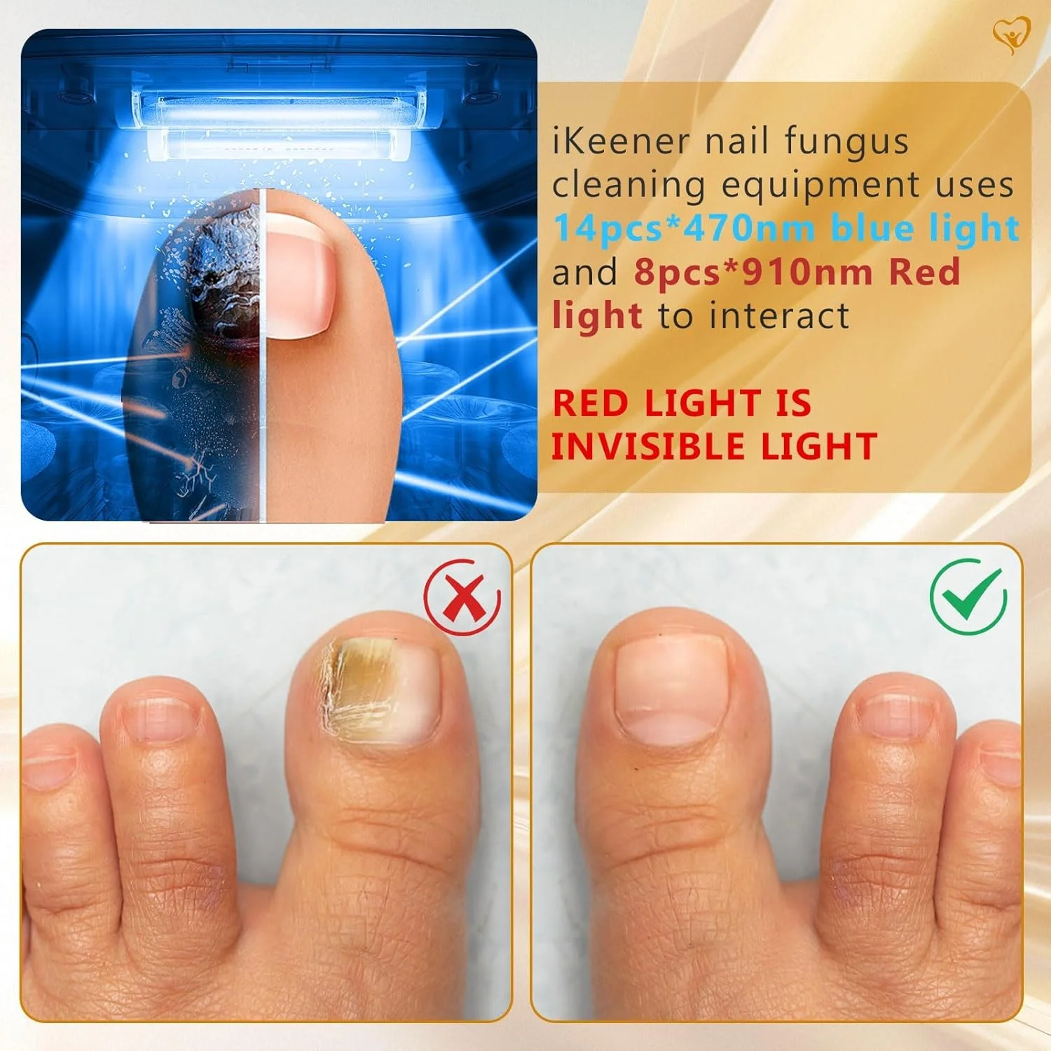 دستگاه لیزر قارچ ناخن بی سیم برای چندین ناخن، استفاده آسان، مناسب برای نور مادون قرمز رنگی و ضخیم شده 470 نانومتر 910 نانومتر آبی
