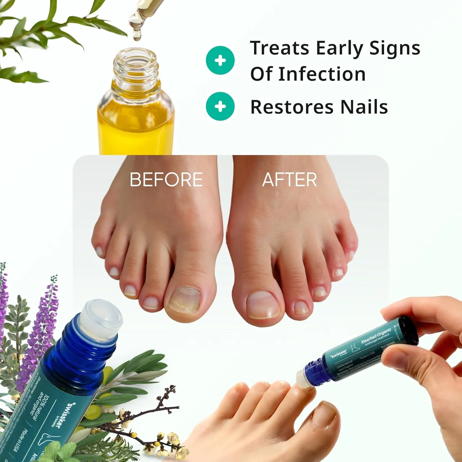 استیک ناخن پا Swissklip Medi-Care I راه حل طبیعی برای ناخن های سالم I مناسب برای پا، انگشتان پا و ناخن های دست I برای ناخن های شکننده - 10 میلی لیتر استیک ناخن پا Swissklip Medi-Care I راه حل طبیعی برای ناخن های سالم I مناسب برای پا، انگشتان پا و ناخن های دست I برای ناخن های شکننده - 10 میلی لیتر