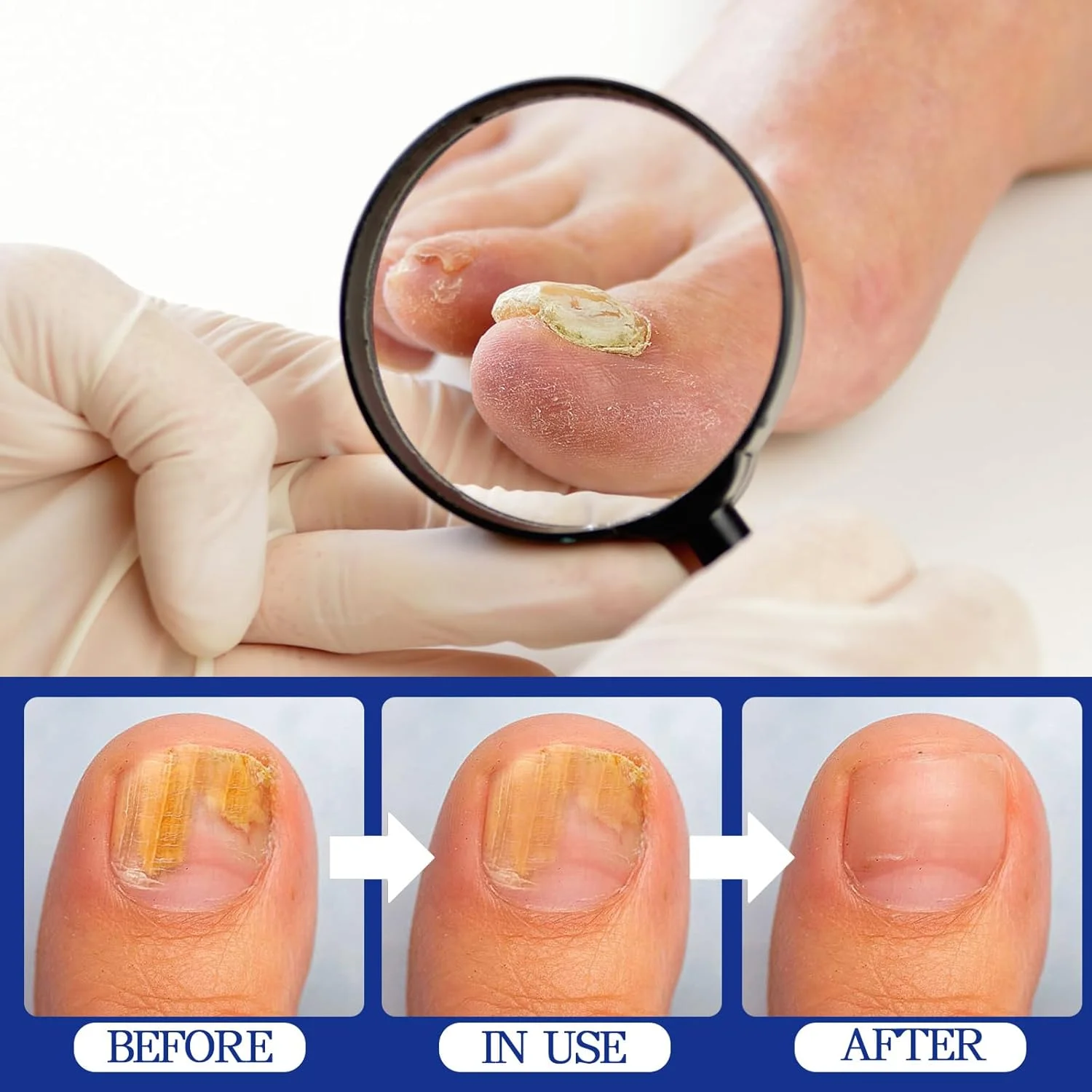 مایع درمان قارچ ناخن آپولیی 30 میلی لیتر، تقویت شده، مایع احیا و ترمیم قوی مراقبت از ناخن برای درمان ناخن های ضخیم، آسیب دیده و تغییر رنگ داده مایع درمان قارچ ناخن آپولیی 30 میلی لیتر، تقویت شده، مایع احیا و ترمیم قوی مراقبت از ناخن برای درمان ناخن های ضخیم، آسیب دیده و تغییر رنگ داده