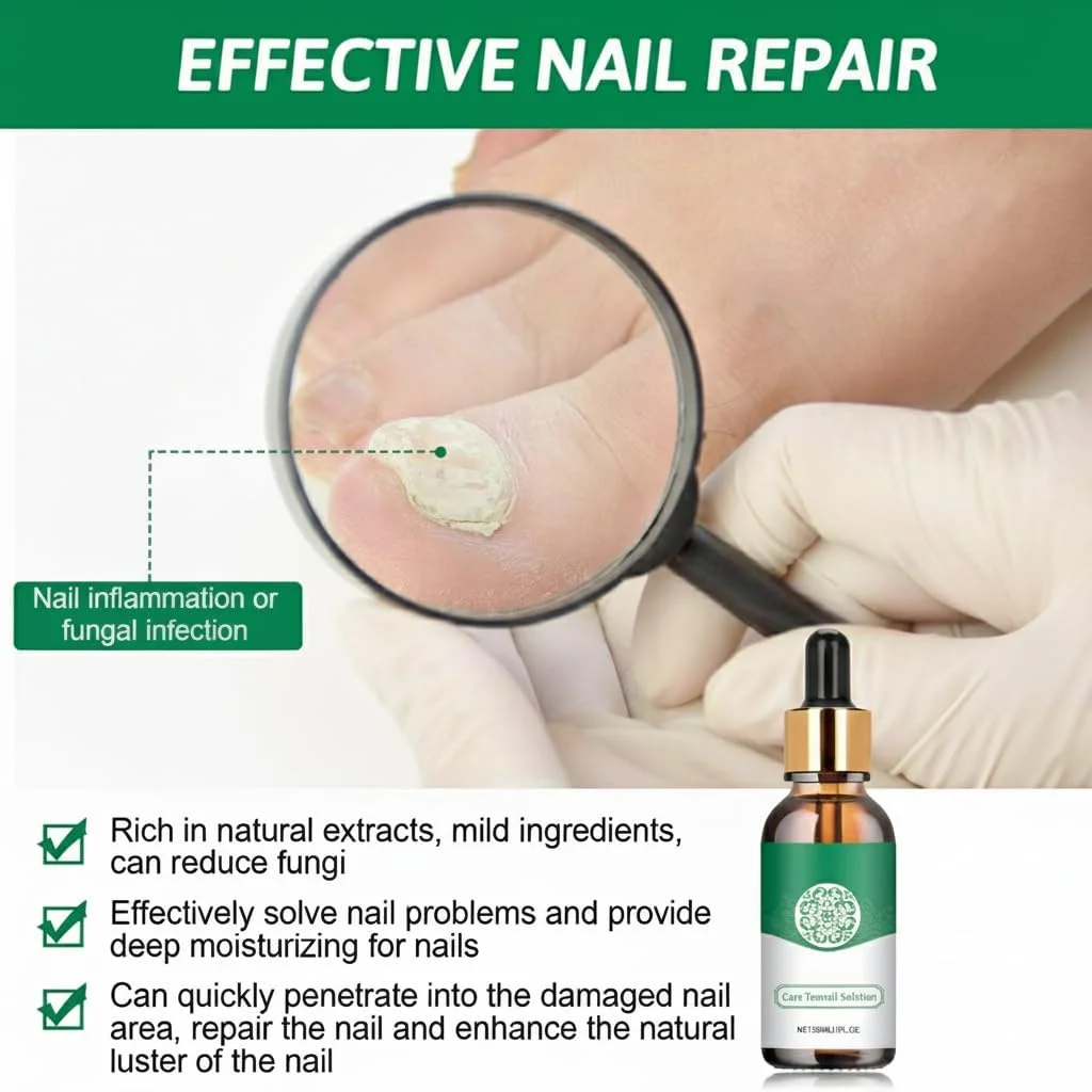 محلول درمان قارچ ناخن Azonee، ترمیم قارچ ناخن پا برای ضخیم شدن، تغییر رنگ زرد-قهوه ای و ترمیم ناخن، 30 میلی لیتر – درمان قوی قارچ ناخن پا و ناخن دست برای ناخن های سالم محلول درمان قارچ ناخن Azonee، ترمیم قارچ ناخن پا برای ضخیم شدن، تغییر رنگ زرد-قهوه ای و ترمیم ناخن، 30 میلی لیتر – درمان قوی قارچ ناخن پا و ناخن دست برای ناخن های سالم