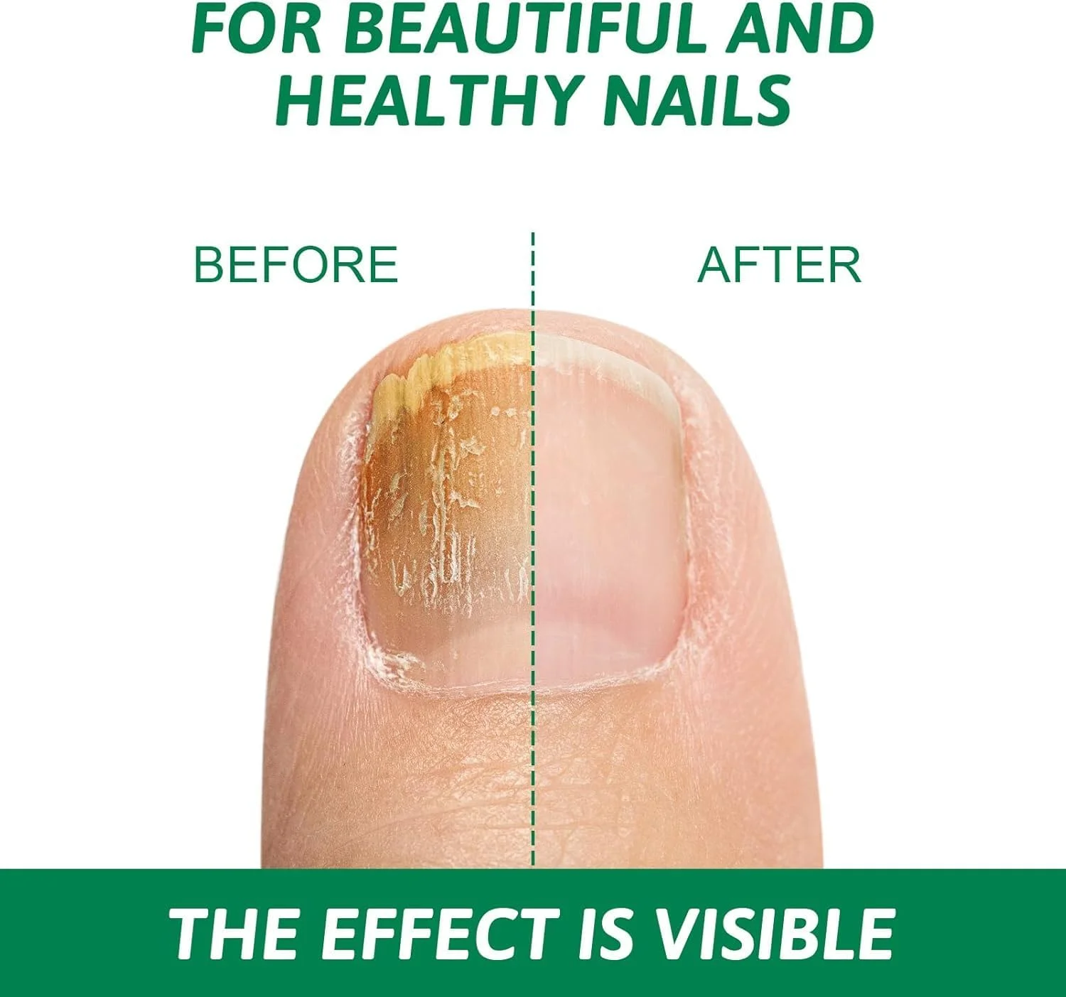 محلول درمان قارچ ناخن GraGra، ترمیم کننده ناخن، درمان قارچ ناخن، ترمیم و نوسازی ناخن های آسیب دیده، محلول قوی از بین برنده قارچ ناخن، محلول ترمیم سریع و قوی ناخن، 20 میلی لیتر