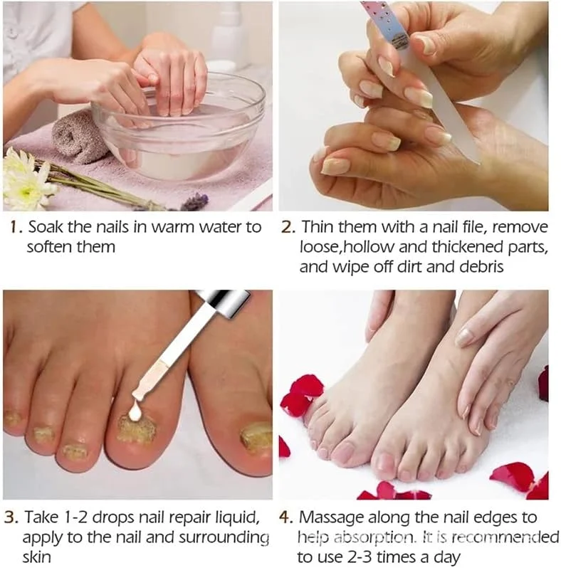 ژل ترمیم کننده و مراقبت از دست و پا حاوی عصاره قارچ، از بین برنده قارچ، ضد عفونت پارونیشیا و اونیکومیکوزیس (1 عدد)