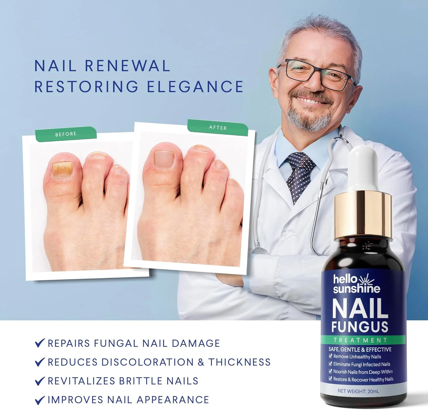 محلول درمان قارچ ناخن پا 20 میلی لیتر محلول درمان قارچ ناخن پا 20 میلی لیتر