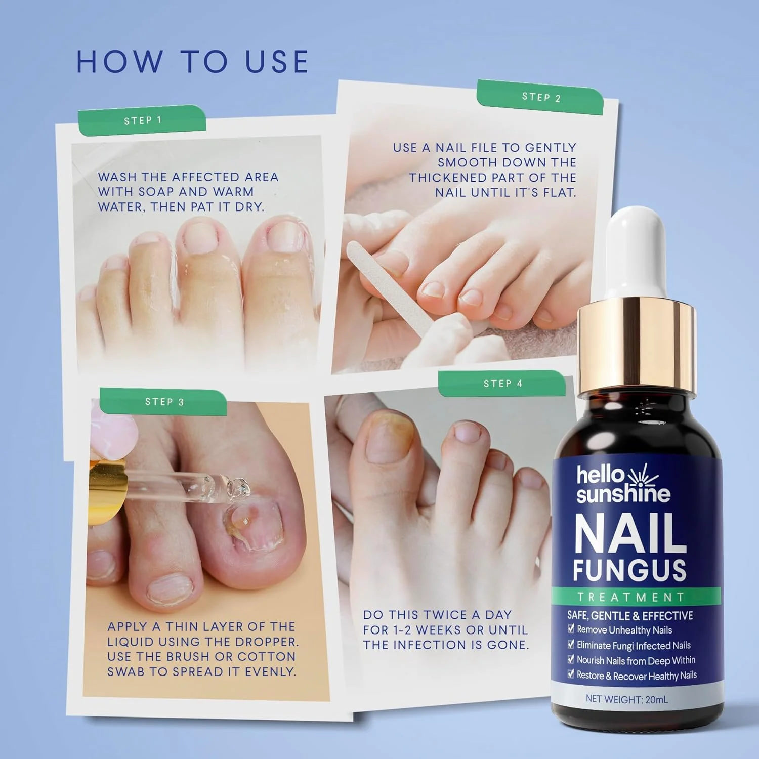 محلول درمان قارچ ناخن پا 20 میلی لیتر محلول درمان قارچ ناخن پا 20 میلی لیتر