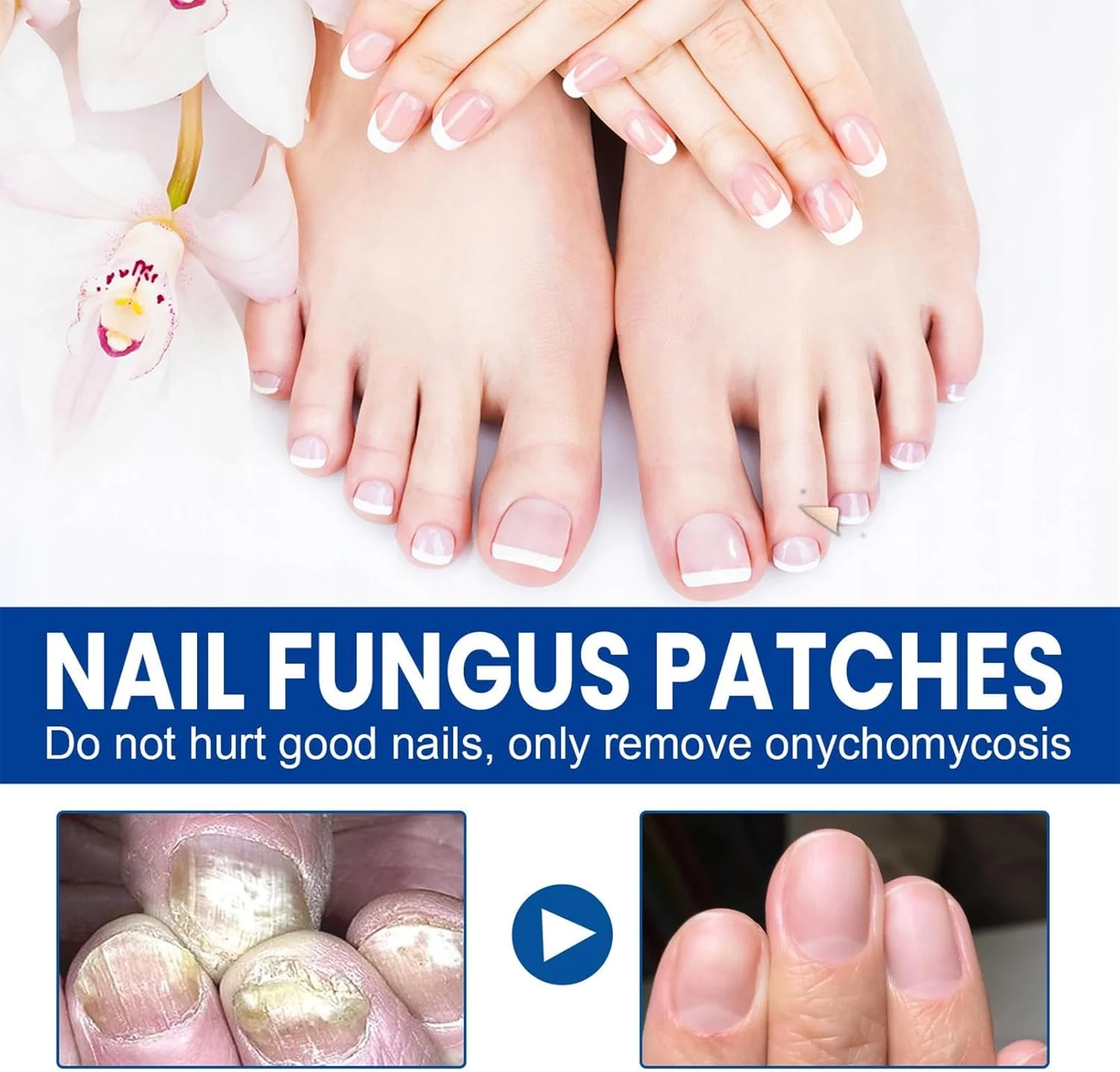 پد درمان قوی قارچ ناخن، 32 پد ترمیم ناخن برای ترمیم موثر ناخن پا، تسکین قارچ ناخن و تقویت رشد سالم، راه حل قدرتمند برای ناخن های آسیب دیده و تسکین ناراحتی پد درمان قوی قارچ ناخن، 32 پد ترمیم ناخن برای ترمیم موثر ناخن پا، تسکین قارچ ناخن و تقویت رشد سالم، راه حل قدرتمند برای ناخن های آسیب دیده و تسکین ناراحتی