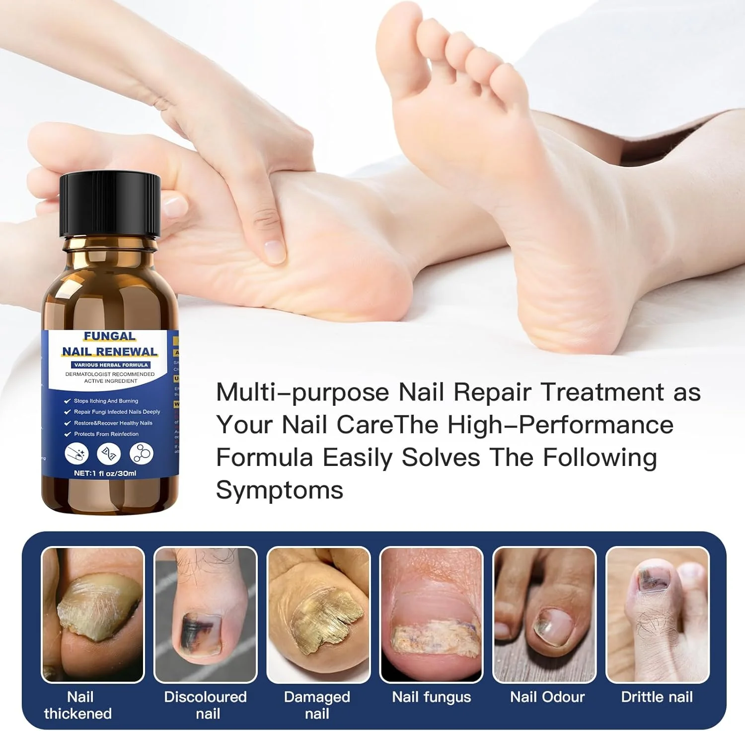 محلول درمان قارچ ناخن پا، قوی ترین درمان قارچ ناخن، درمان پای ورزشکاران، درمان ناخن فرورفته در گوشت، درمان قارچ ناخن پا برای ناخن های قارچی (30 میلی لیتر) محلول درمان قارچ ناخن پا، قوی ترین درمان قارچ ناخن، درمان پای ورزشکاران، درمان ناخن فرورفته در گوشت، درمان قارچ ناخن پا برای ناخن های قارچی (30 میلی لیتر)