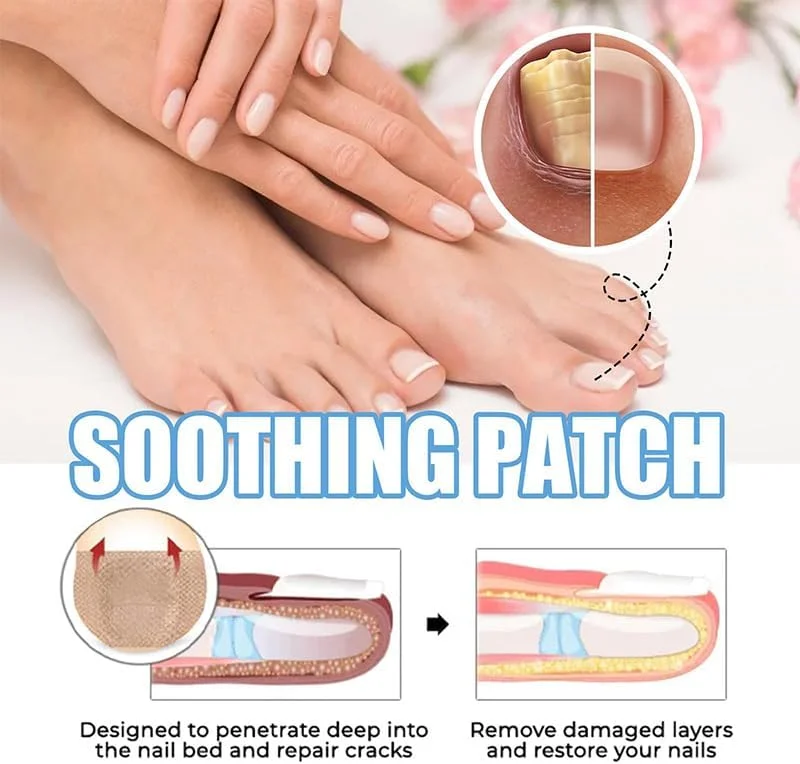 پد درمان قارچ ناخن پا با قدرت فوق العاده، ترمیم 24 ساعته شبانه، پد ضد قارچ ناخن برای تسکین قارچ ناخن پا، درمان قارچ ناخن پا (32 عدد) پد درمان قارچ ناخن پا با قدرت فوق العاده، ترمیم 24 ساعته شبانه، پد ضد قارچ ناخن برای تسکین قارچ ناخن پا، درمان قارچ ناخن پا (32 عدد)