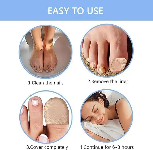 پد درمان قارچ ناخن پا با قدرت فوق العاده، ترمیم 24 ساعته شبانه، پد ضد قارچ ناخن برای تسکین قارچ ناخن پا، درمان قارچ ناخن پا (32 عدد) پد درمان قارچ ناخن پا با قدرت فوق العاده، ترمیم 24 ساعته شبانه، پد ضد قارچ ناخن برای تسکین قارچ ناخن پا، درمان قارچ ناخن پا (32 عدد)