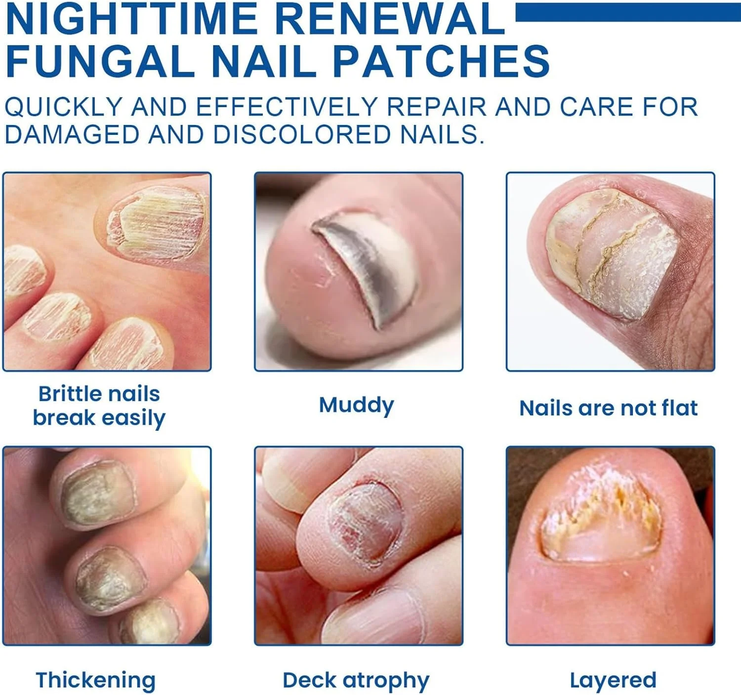 برچسب های درمان قارچ ناخن TERRIFI - ترمیم کننده قوی قارچ ناخن پا، درمان 8 ساعته شبانه برای قارچ ناخن (32 عدد) برچسب های درمان قارچ ناخن TERRIFI - ترمیم کننده قوی قارچ ناخن پا، درمان 8 ساعته شبانه برای قارچ ناخن (32 عدد)