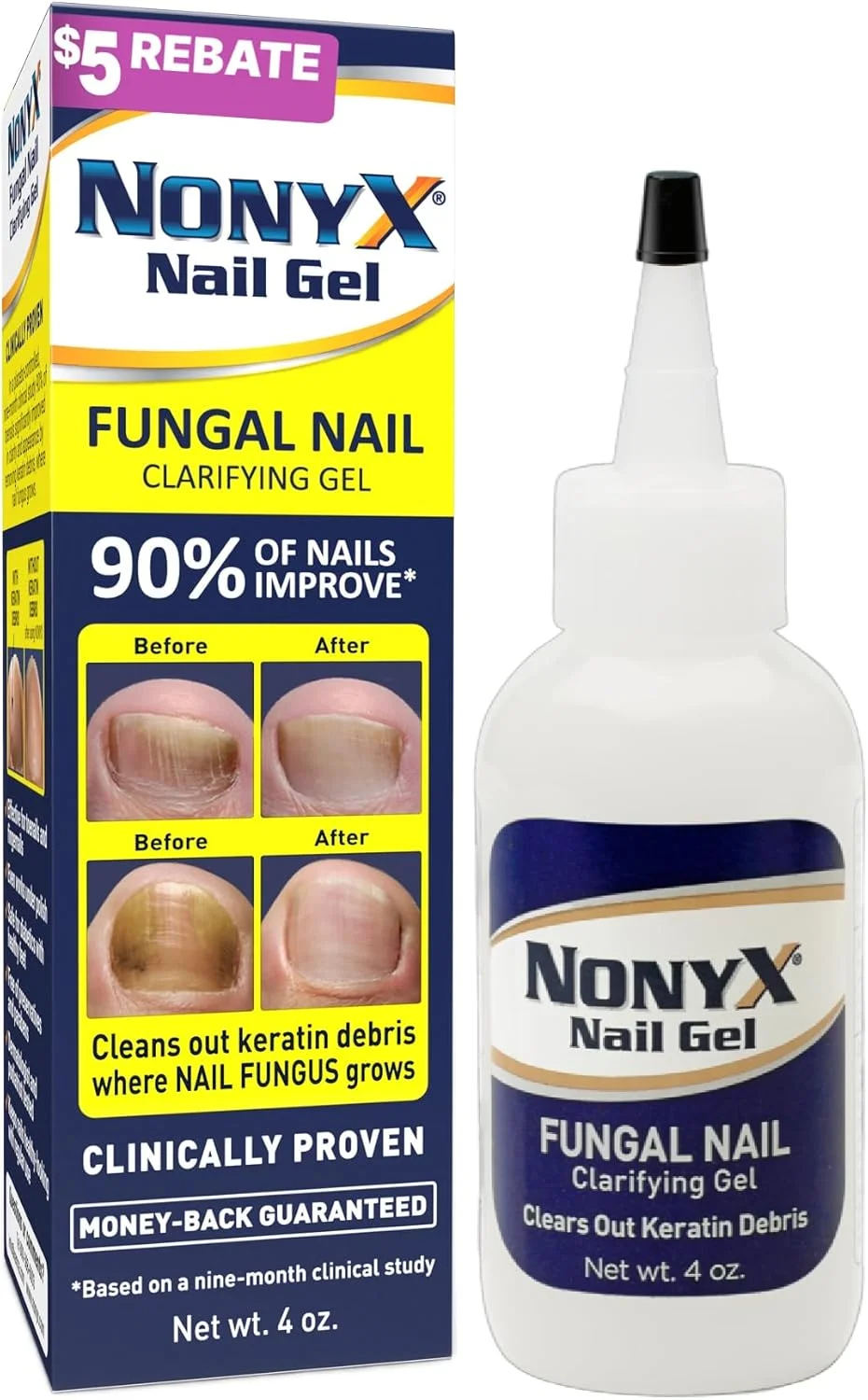 ژل شفاف کننده ناخن قارچی Nonyx، پاک کننده مواد زائد کراتینی - 118 میلی لیتر ژل شفاف کننده ناخن قارچی Nonyx، پاک کننده مواد زائد کراتینی - 118 میلی لیتر