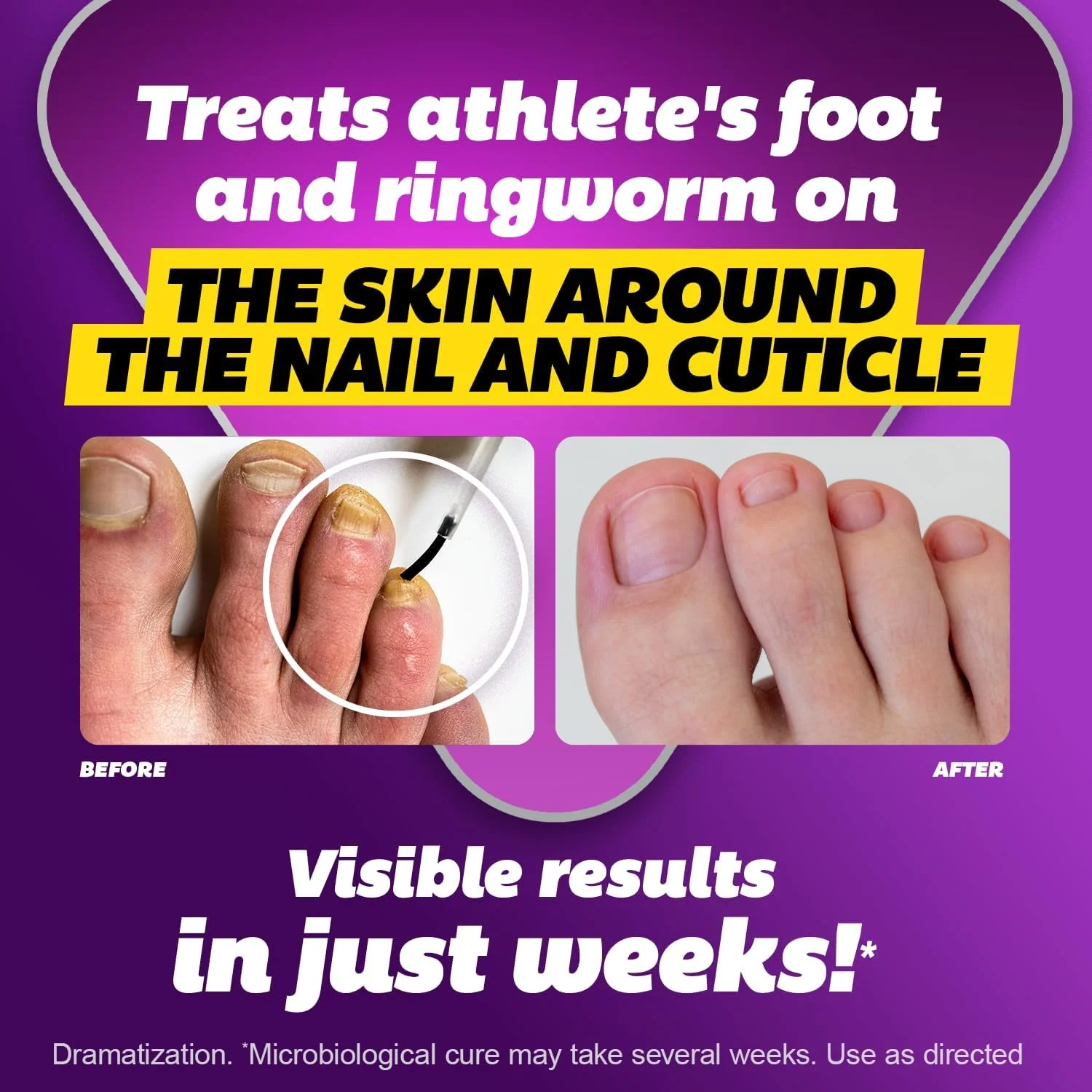 مایع ضد قارچ سیلکا با حداکثر قدرت برای سلامت ناخن پا به همراه برس اپلیکاتور، نتیجه در 1 هفته، درمان قارچ ناخن برای ناخن های آسیب دیده، درمان پای ورزشکاران، تولنافتات 1% 0.45 Fl Oz