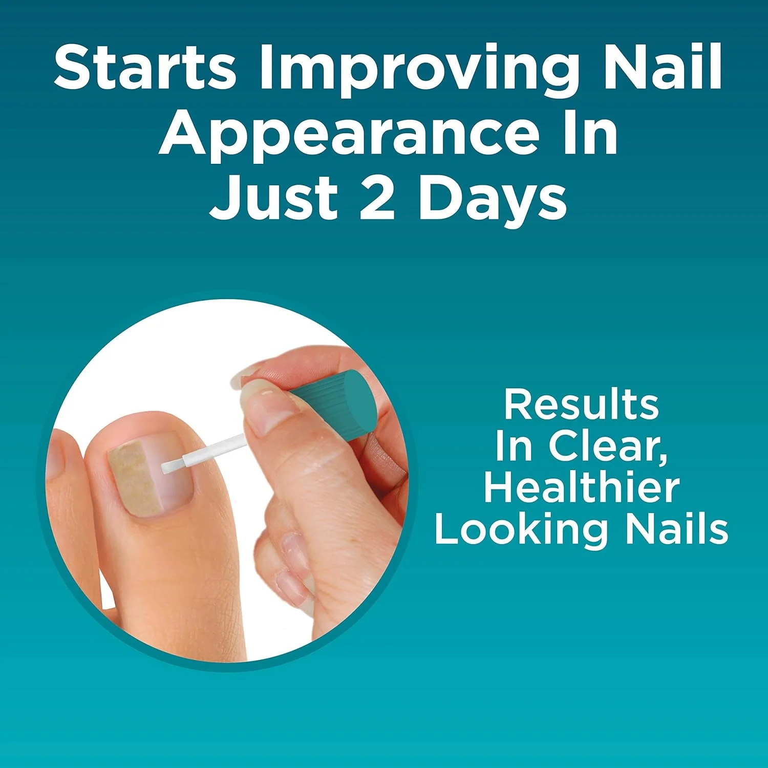 محلول دو کاره ترمیم ناخن قارچی Opti-Nail، بهبود ظاهر ناخن و از بین بردن قارچ اطراف ناخن. محلول دو کاره ترمیم ناخن قارچی Opti-Nail، بهبود ظاهر ناخن و از بین بردن قارچ اطراف ناخن.