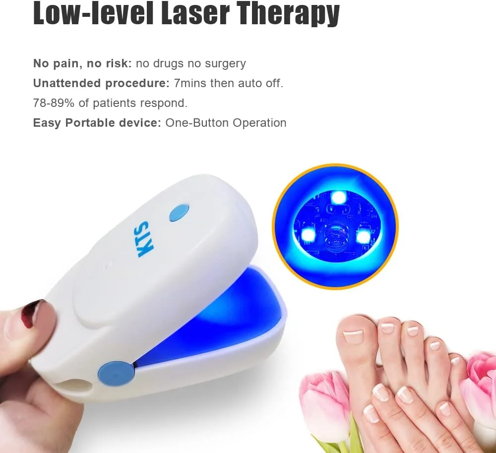 دستگاه درمان قارچ ناخن شارژی KTS برای اونیکومیکوز، نور درمانی بسیار موثر برای پاکسازی ناخن دستگاه درمان قارچ ناخن شارژی KTS برای اونیکومیکوز، نور درمانی بسیار موثر برای پاکسازی ناخن