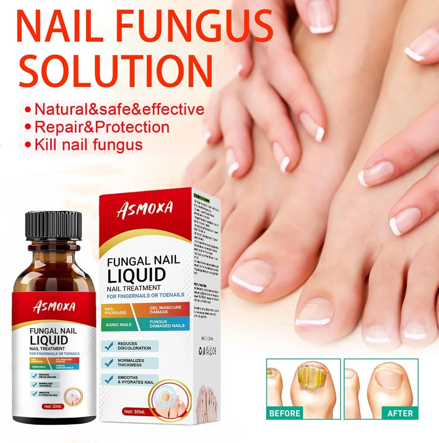 محلول درمان قارچ ناخن LBOYLOVE® با قدرت فوق العاده، درمان قارچ ناخن، درمان قارچ ناخن پا، درمان پای ورزشکاران، درمان قارچ ناخن پا برای ناخن های قارچی (30 میلی لیتر) محلول درمان قارچ ناخن LBOYLOVE® با قدرت فوق العاده، درمان قارچ ناخن، درمان قارچ ناخن پا، درمان پای ورزشکاران، درمان قارچ ناخن پا برای ناخن های قارچی (30 میلی لیتر)